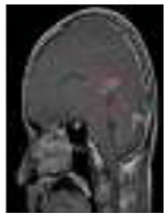 Diagnostics 13 01153 i007