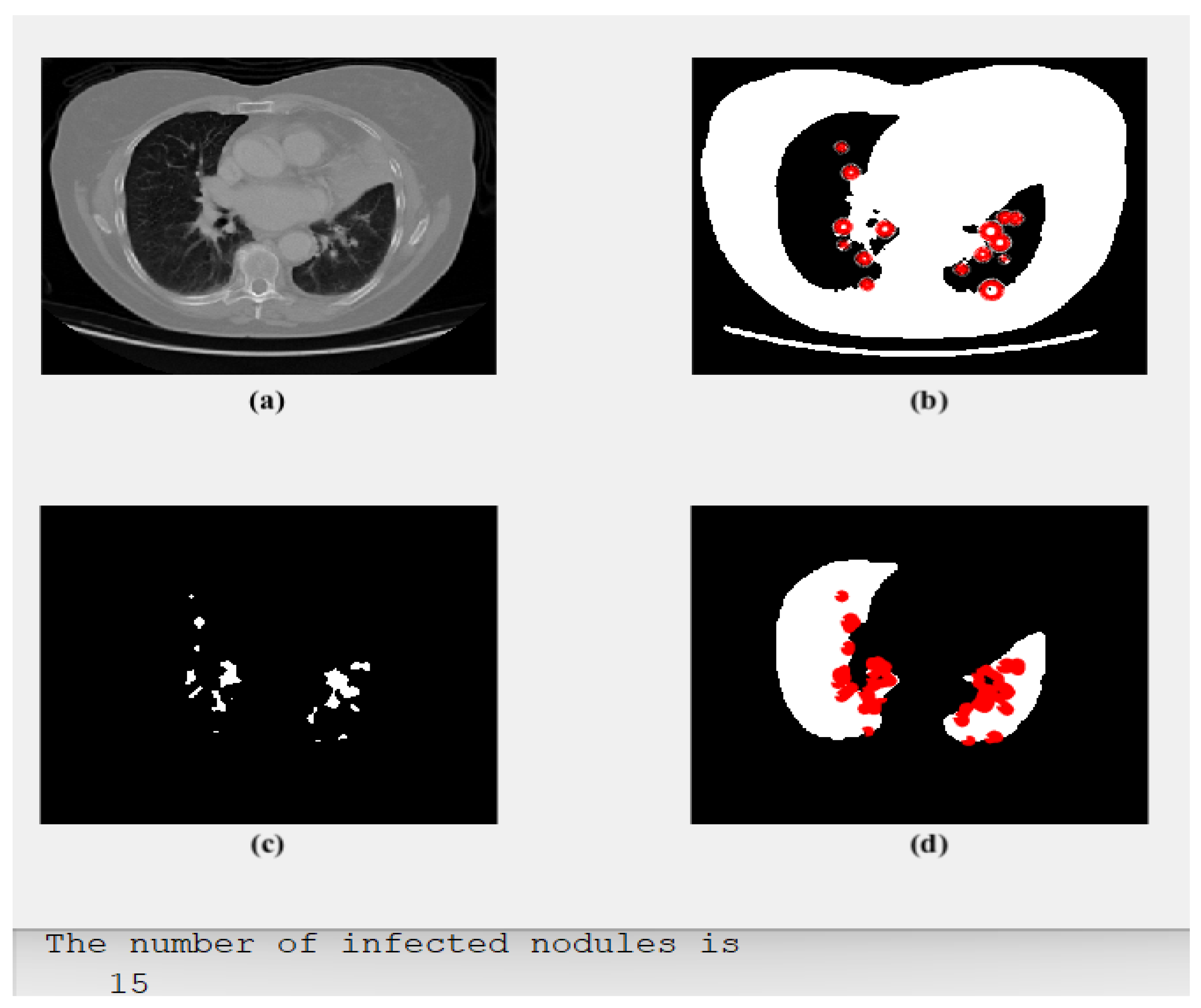 Diagnostics 13 01174 g003