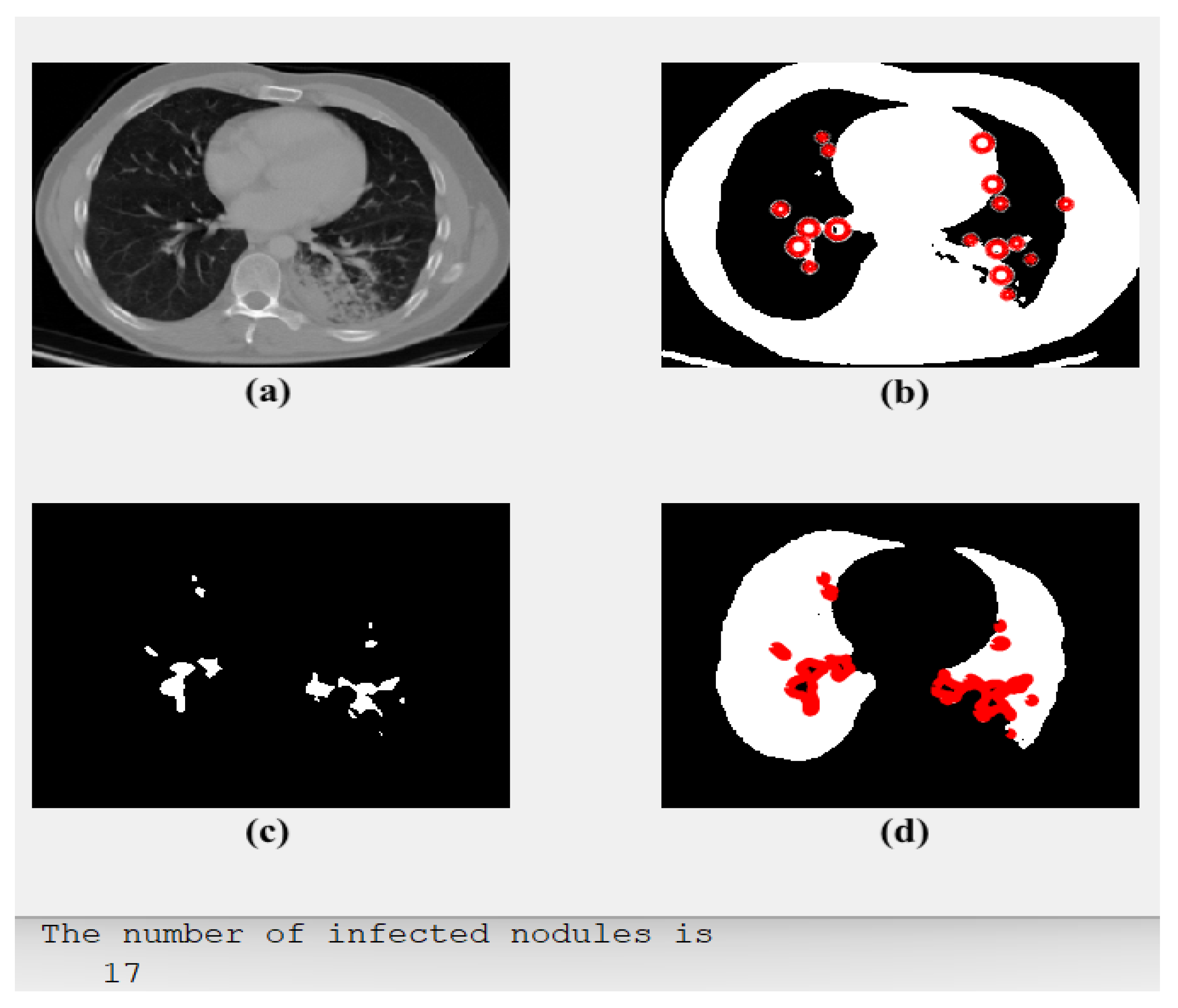 Diagnostics 13 01174 g005