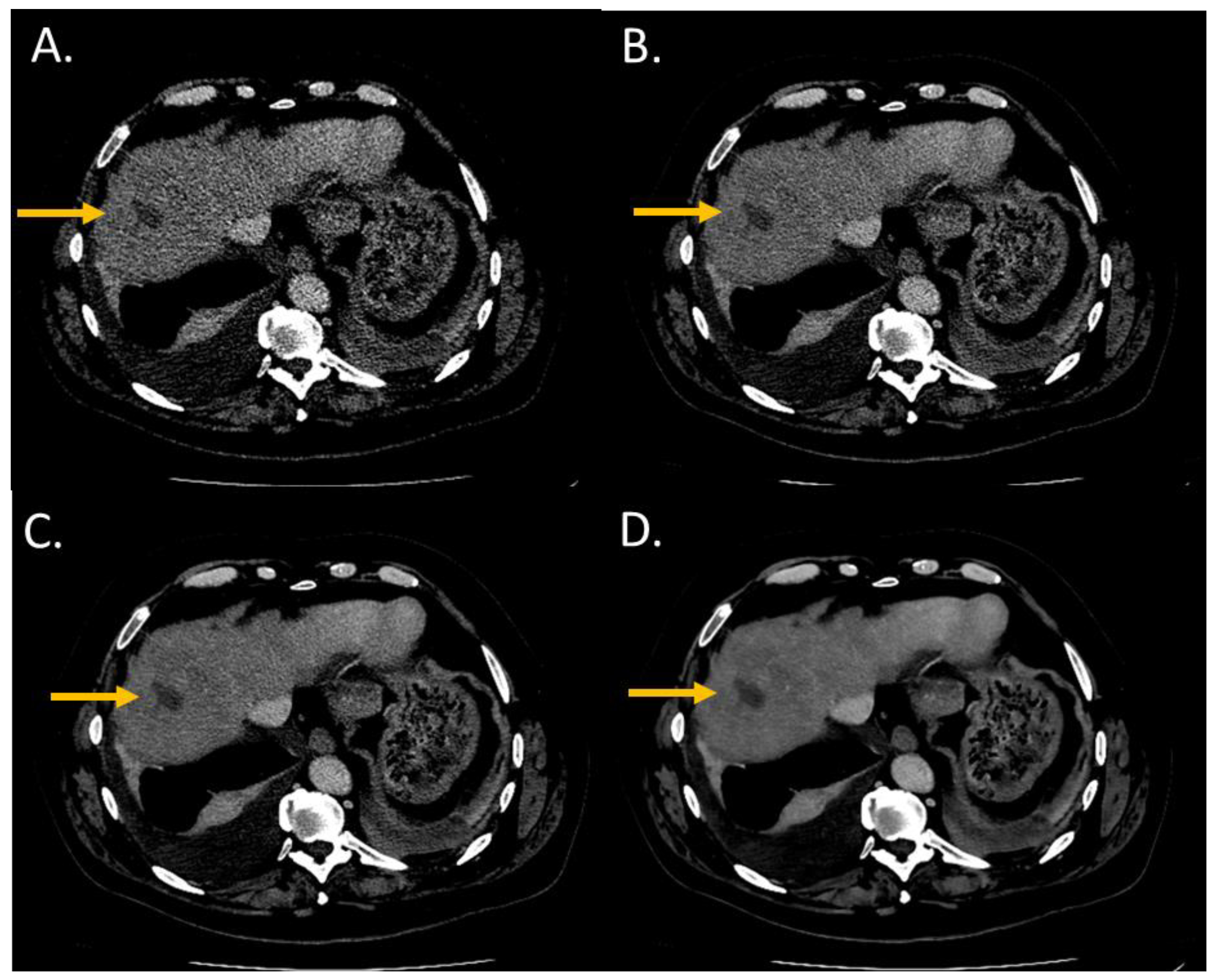 Diagnostics 13 01182 g003 Diagnostics 13 01182 g003