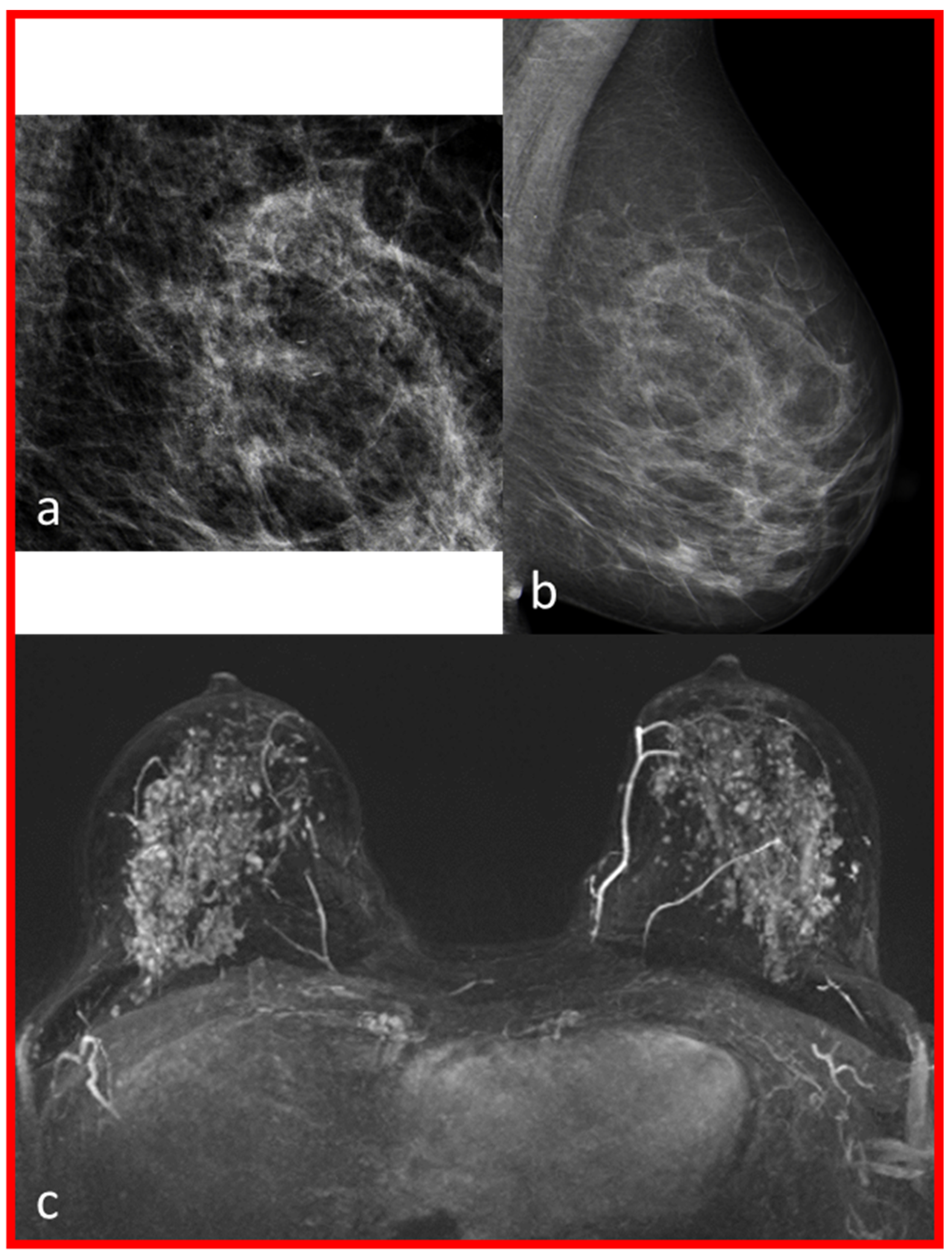 Diagnostics 13 01197 g002 Diagnostics 13 01197 g002