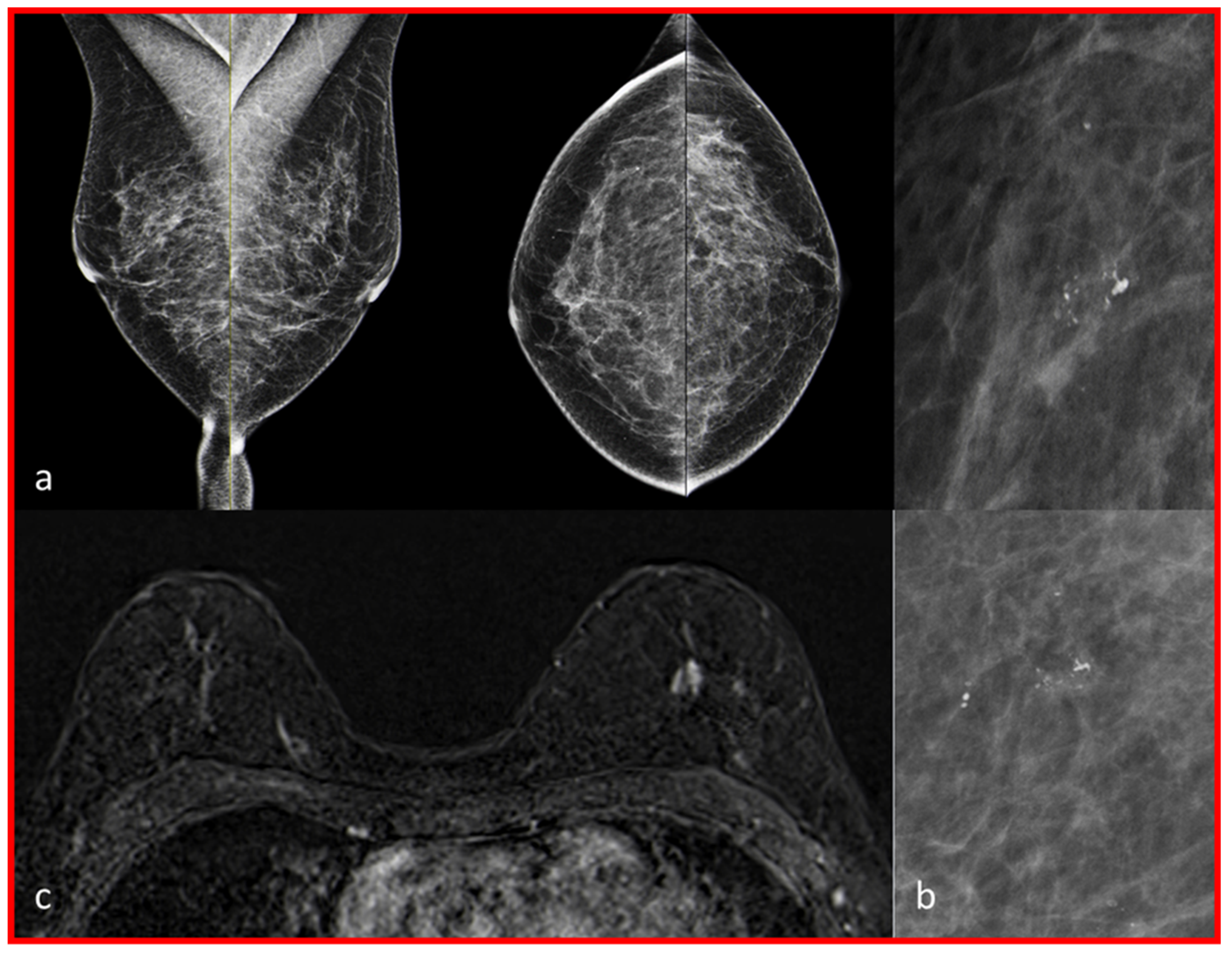 Diagnostics 13 01197 g003 Diagnostics 13 01197 g003