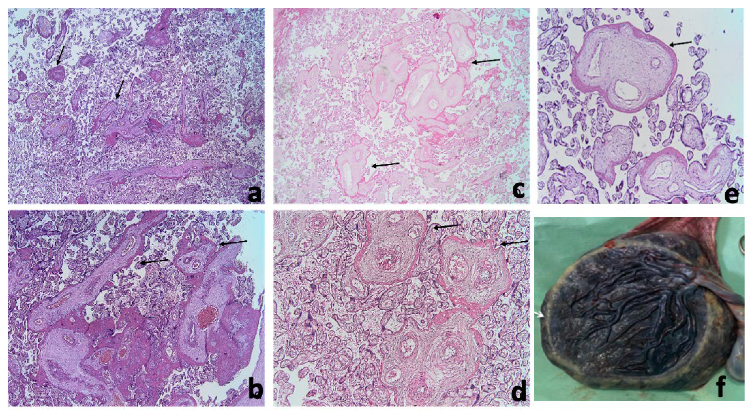Diagnostics 13 01200 g004