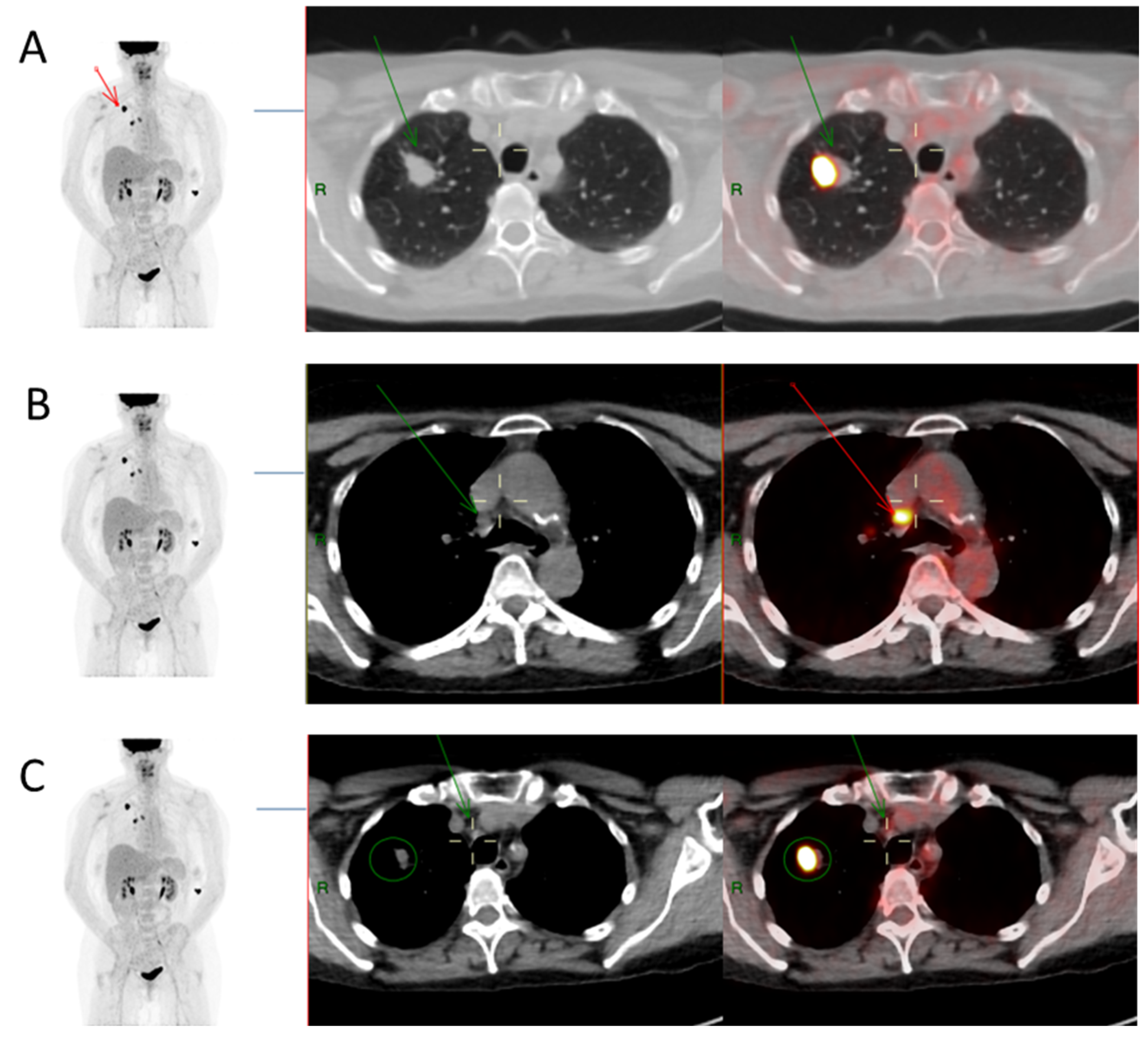Diagnostics Free FullText A Comparative Evaluation of Mediastinal