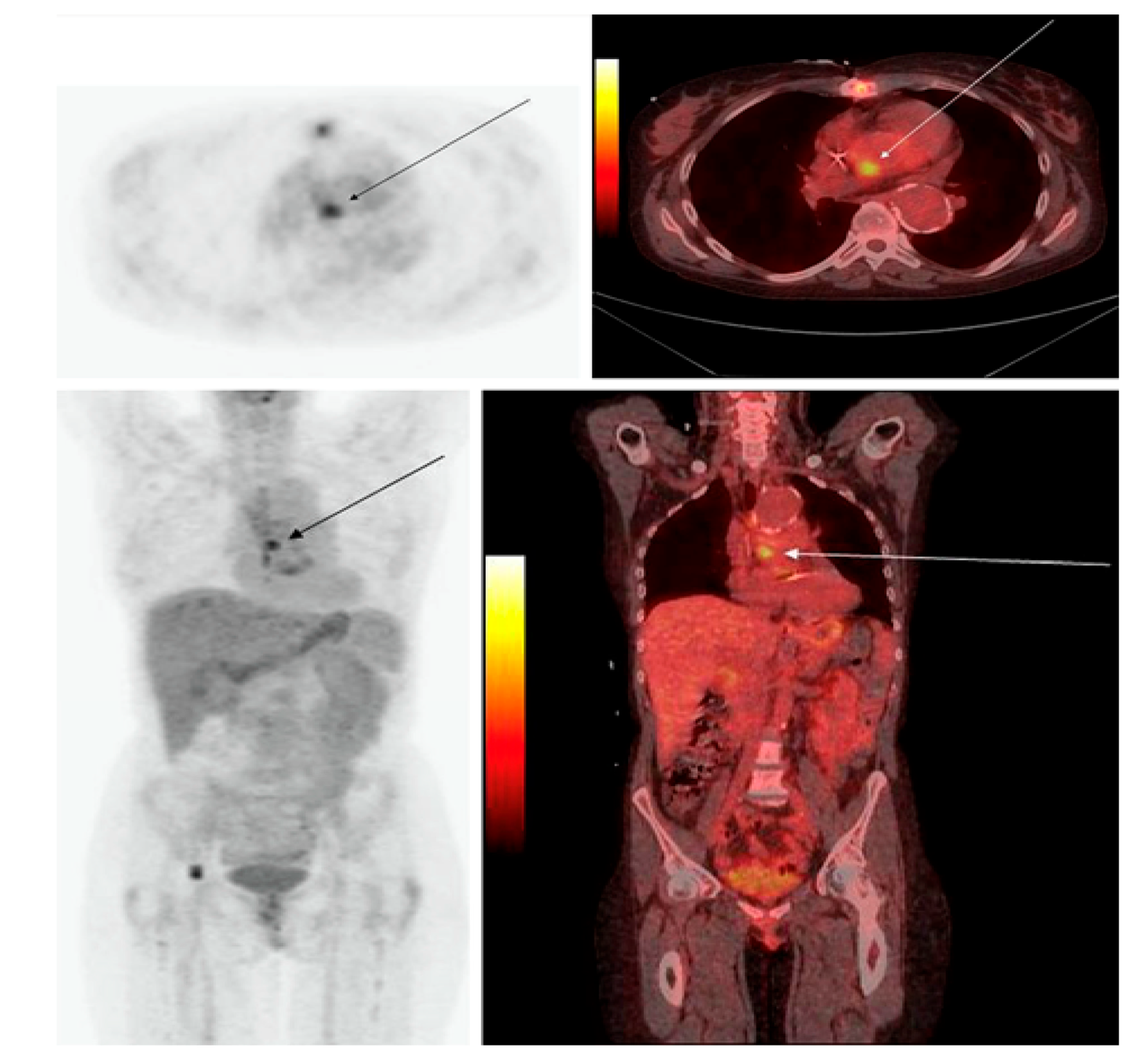 Diagnostics 13 01231 g003 Diagnostics 13 01231 g003