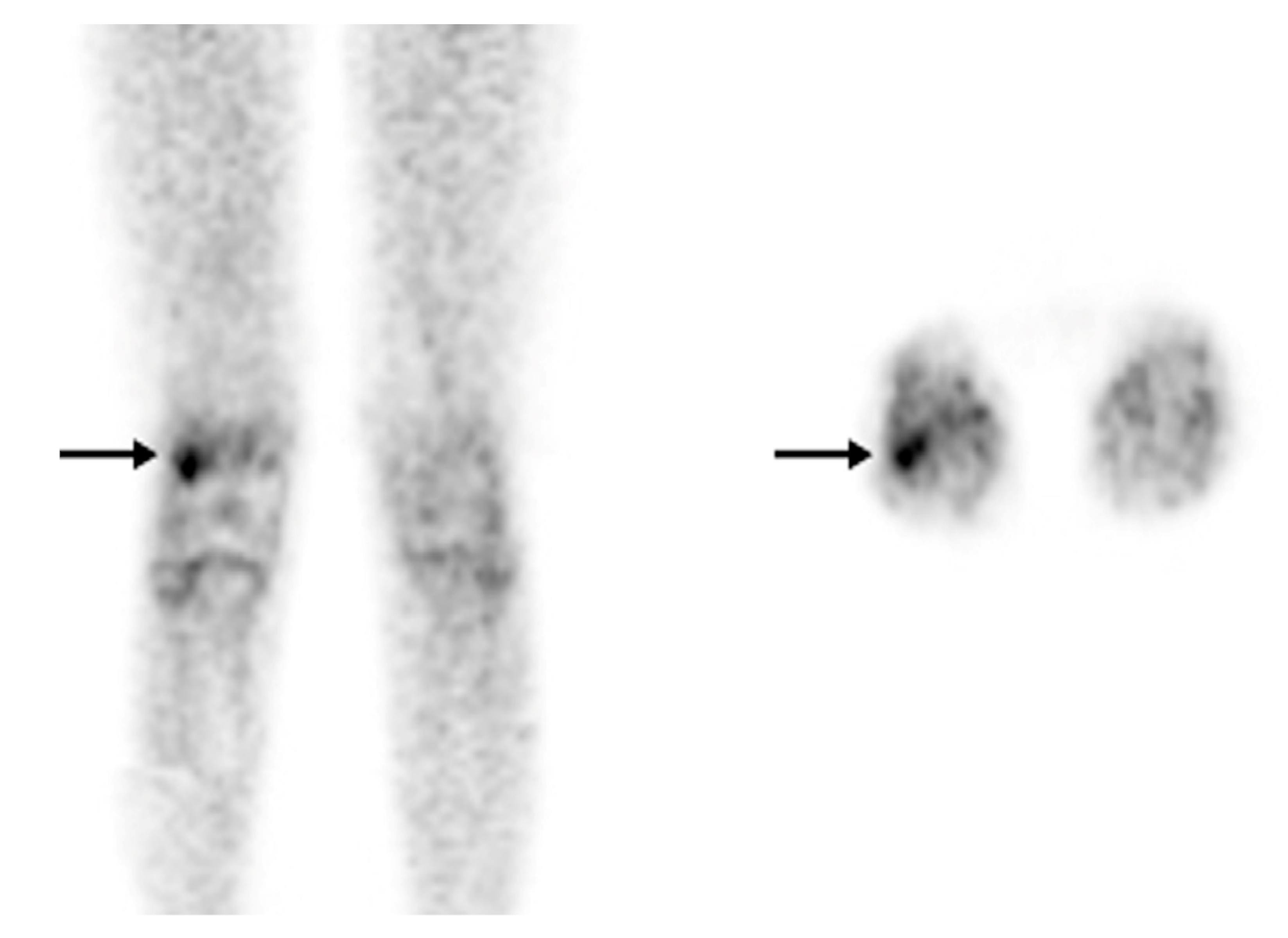 Diagnostics 13 01231 g004 Diagnostics 13 01231 g004