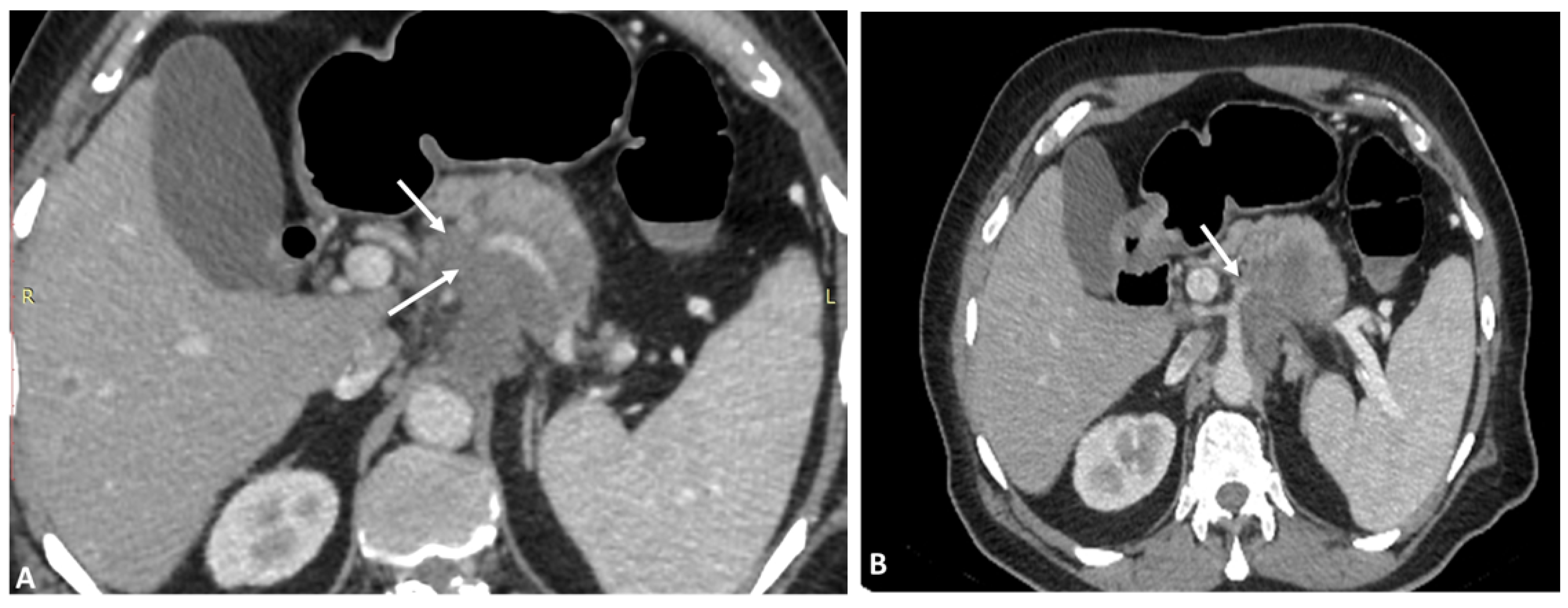 Diagnostics 13 01233 g007 Diagnostics 13 01233 g007