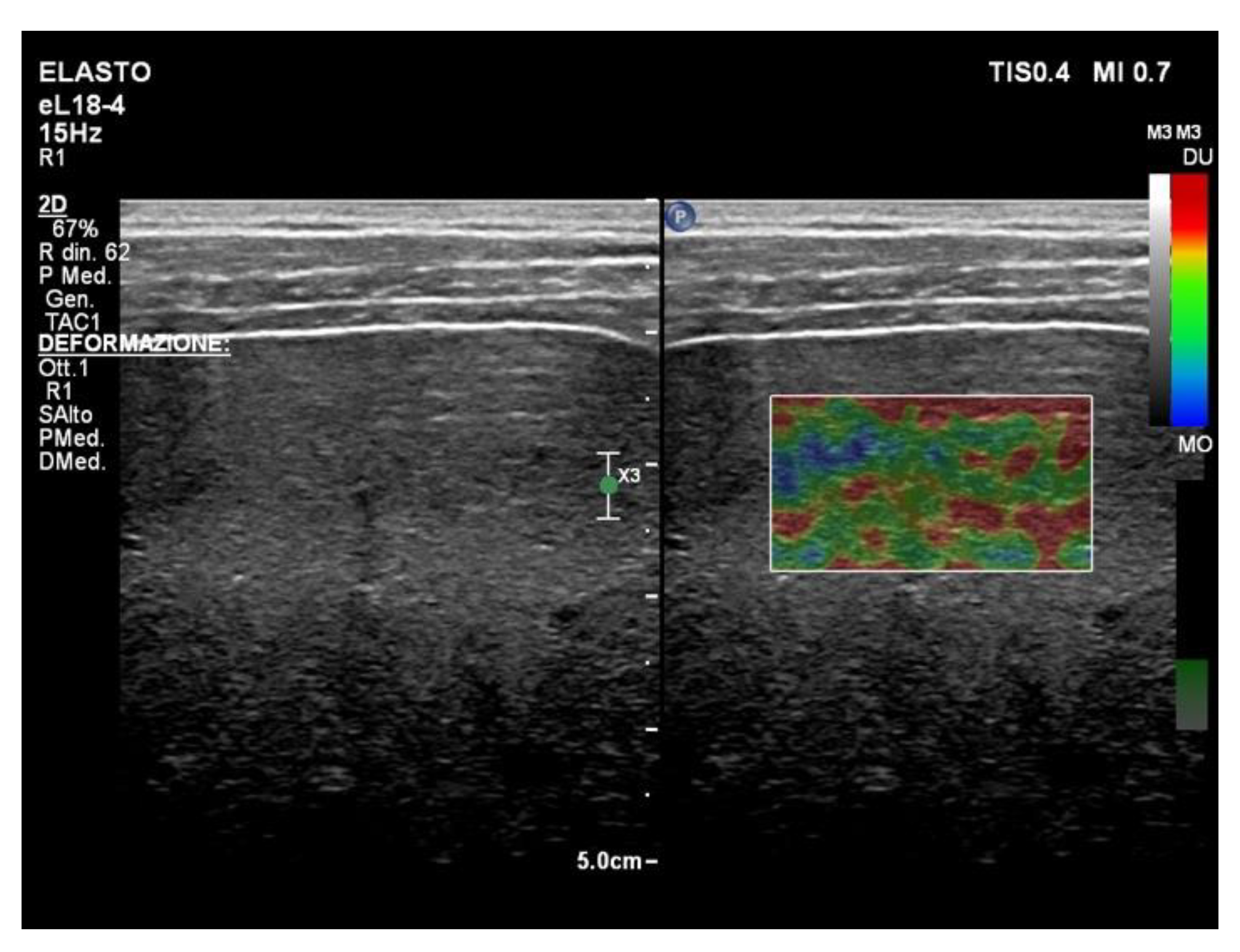 Diagnostics 13 01236 g003 Diagnostics 13 01236 g003