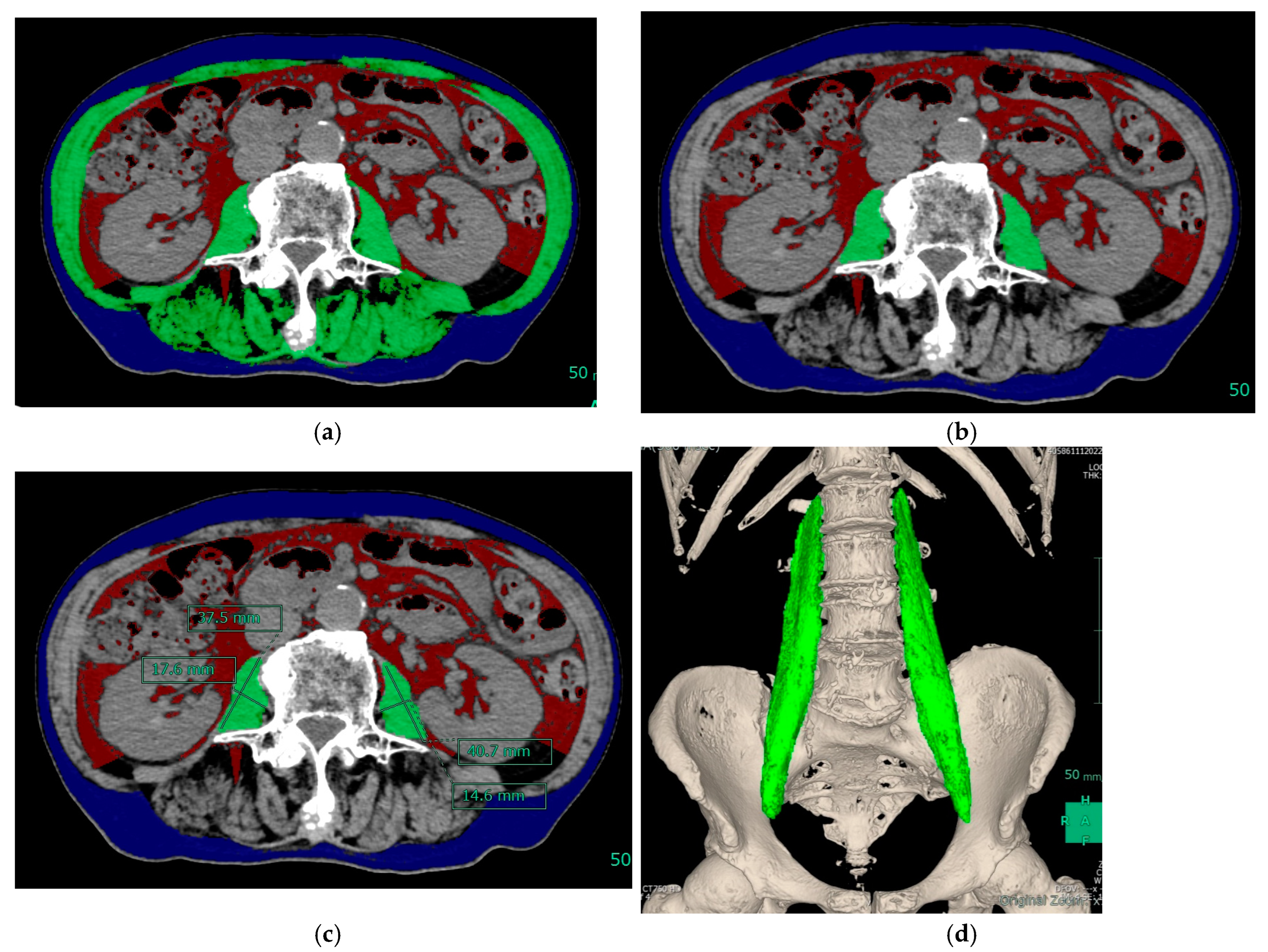 Diagnostics 13 01245 g001