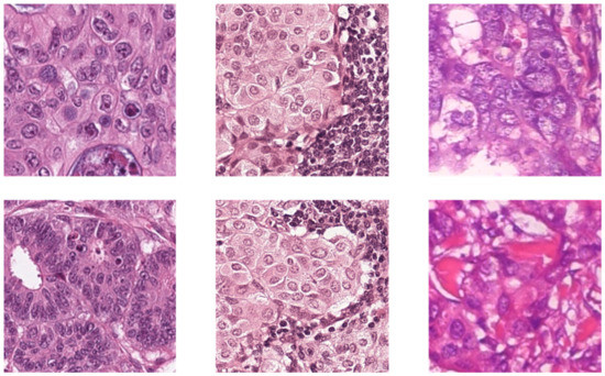 Automatic Classification of Histopathology Images across Multiple ...