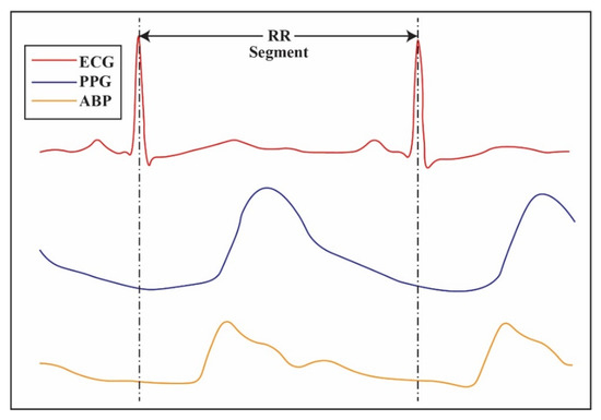 A Novel Cuffless Blood Pressure Prediction: Uncovering New Features and ...