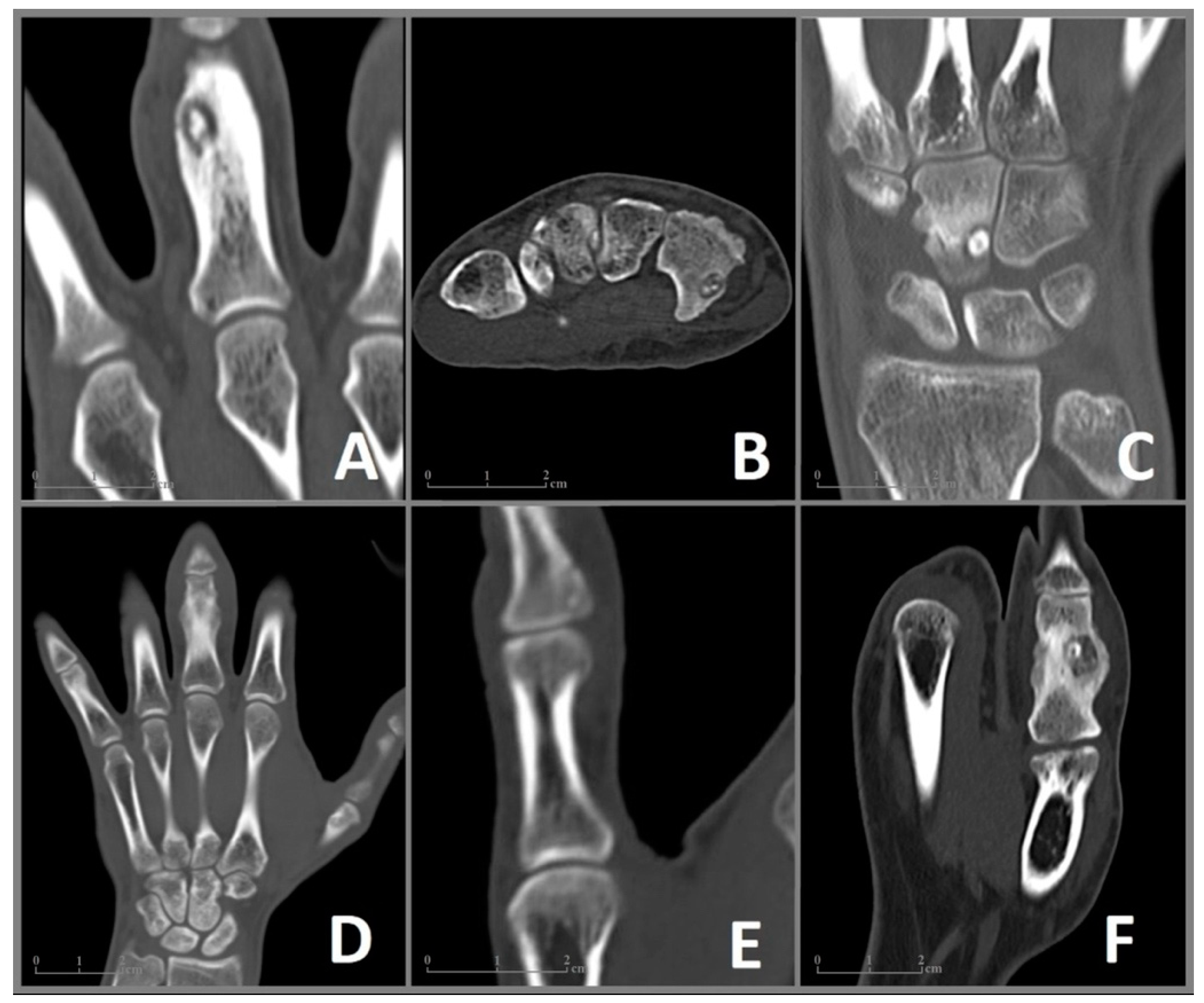 Diagnostics 13 01279 g002 Diagnostics 13 01279 g002
