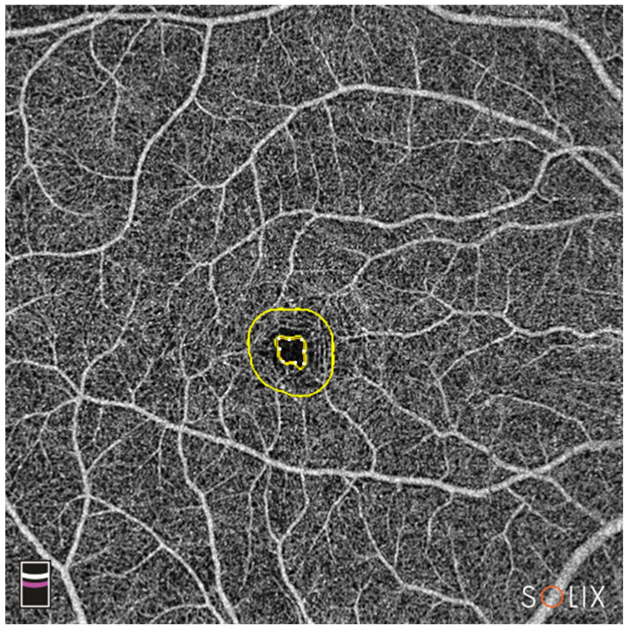 Diagnostics 13 01283 g004 Diagnostics 13 01283 g004