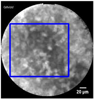 Diagnostics 13 01289 i002