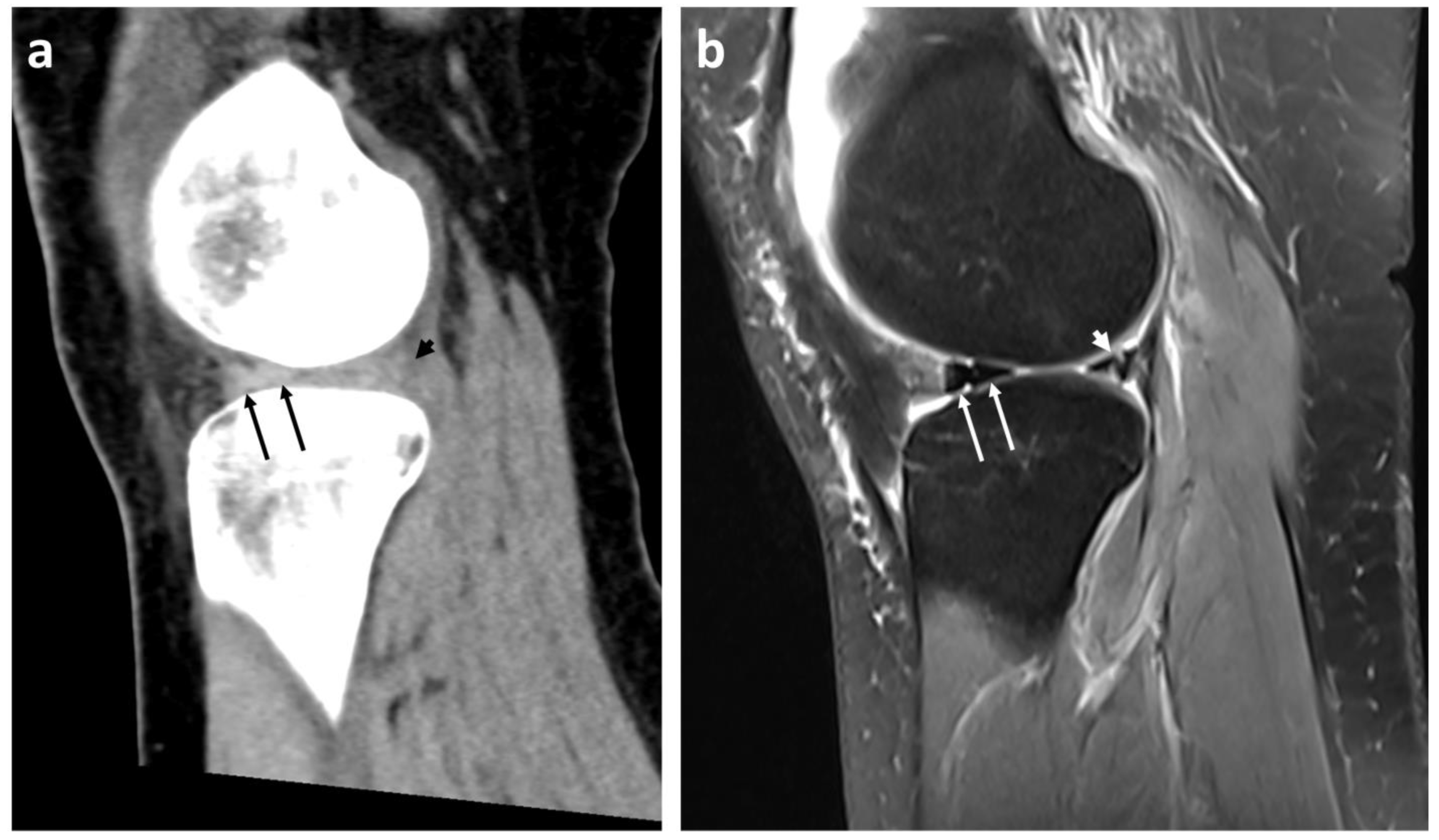 Diagnostics Free FullText Diagnostic Accuracy of 128Slice SingleSource CT for the
