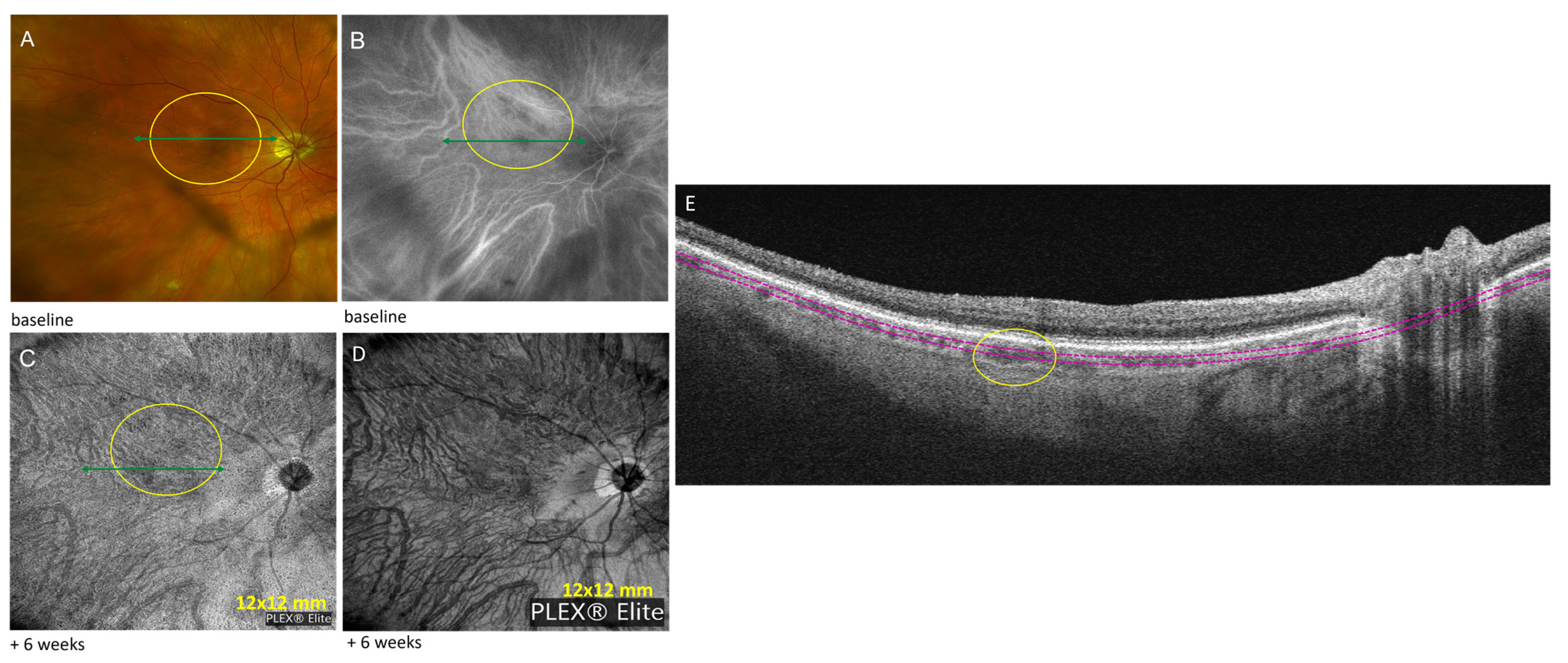 Diagnostics 13 01296 g002 Diagnostics 13 01296 g002