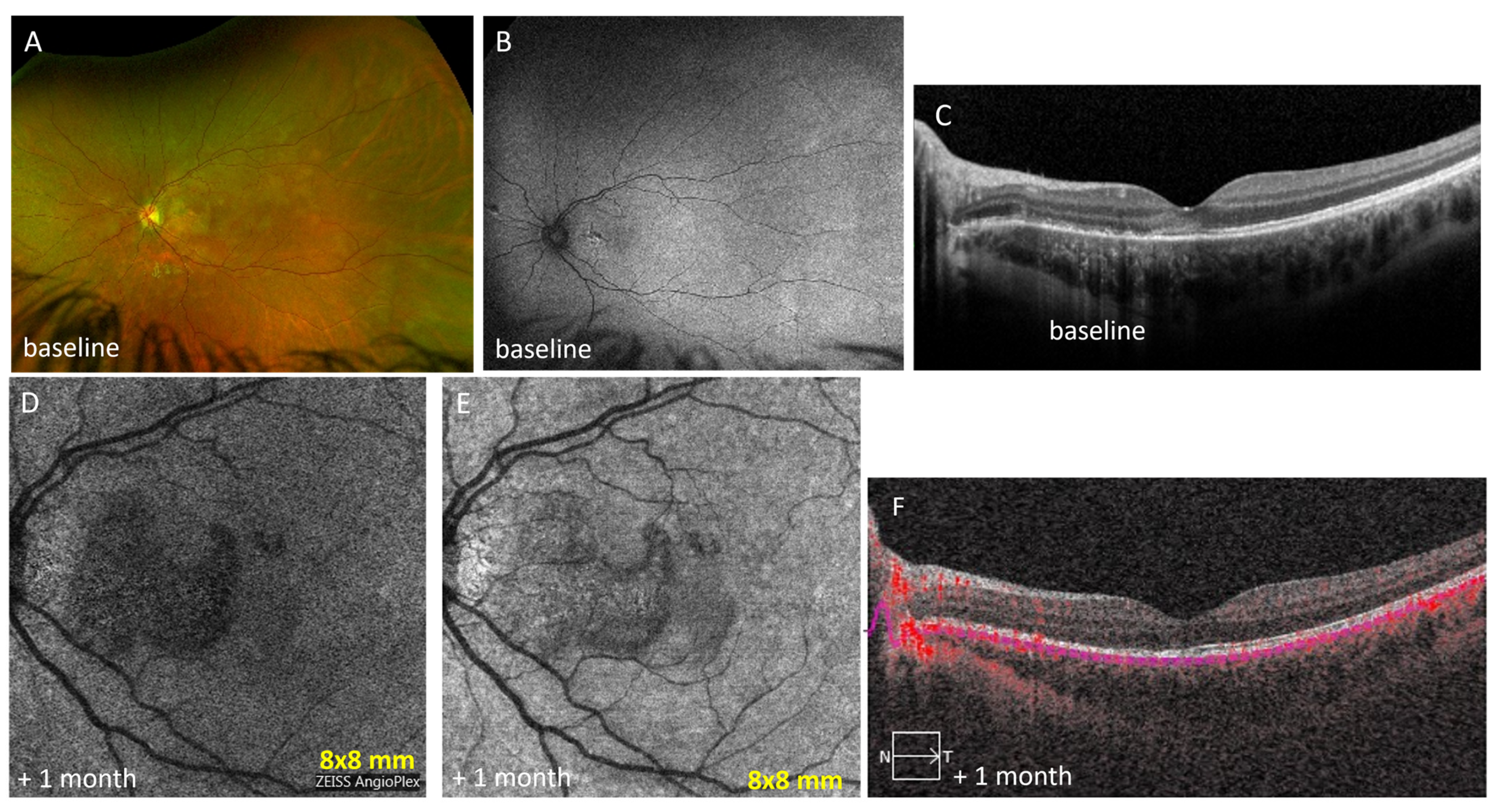 Diagnostics 13 01296 g005 Diagnostics 13 01296 g005