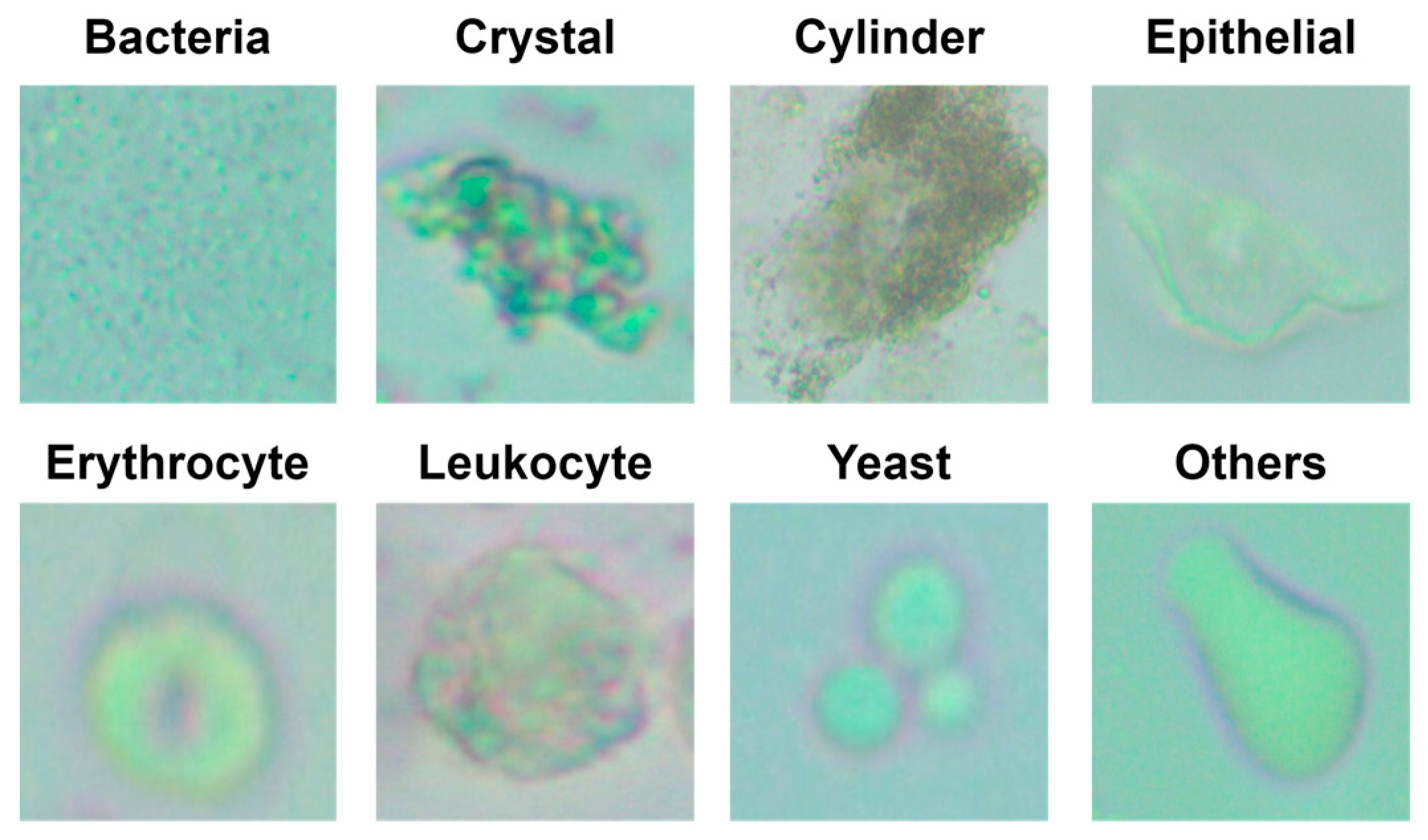 Inspection of visible components in urine based on deep learning