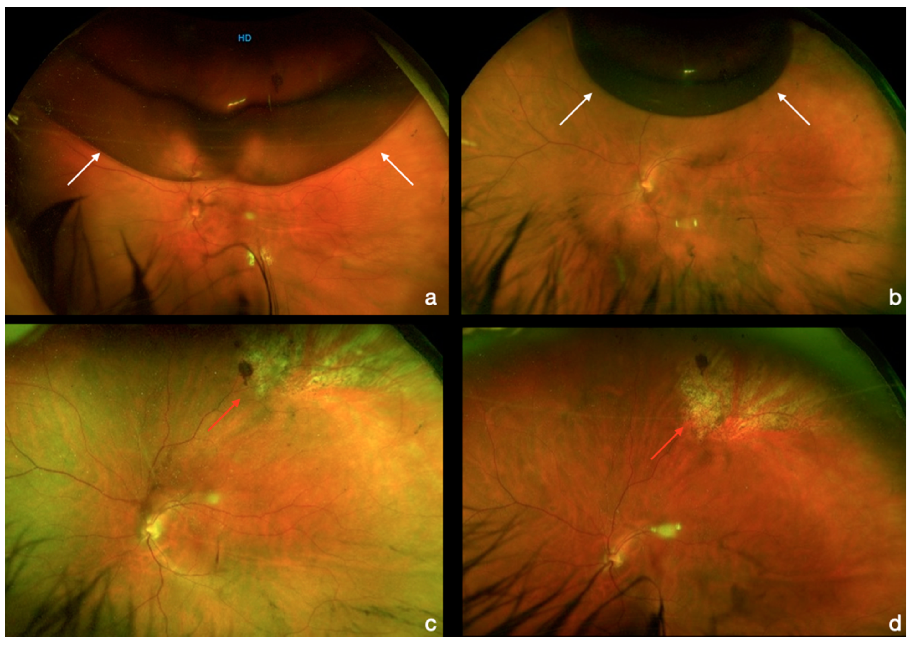 Diagnostics 13 01301 g004
