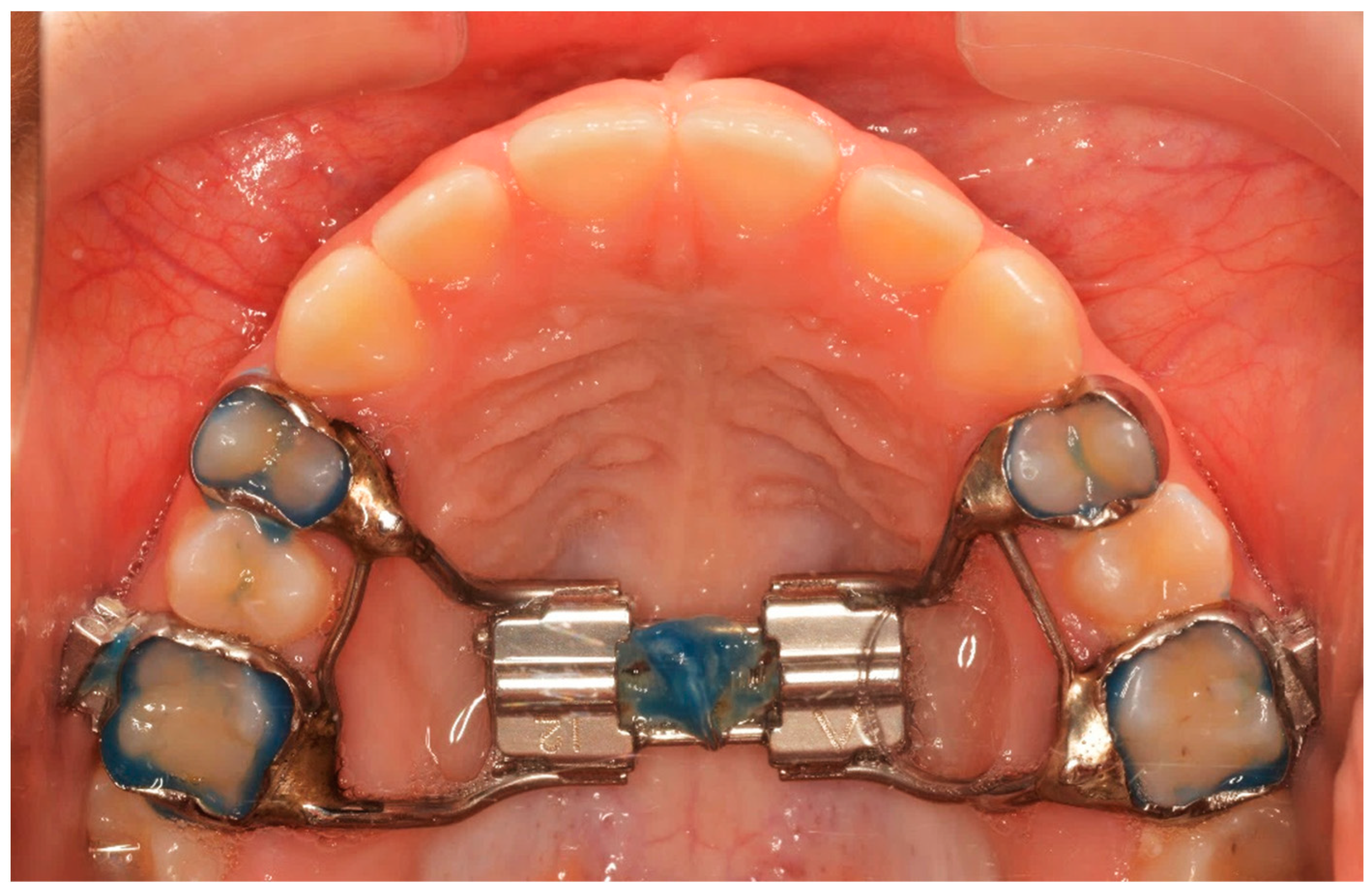 Diagnostics 13 01322 g001