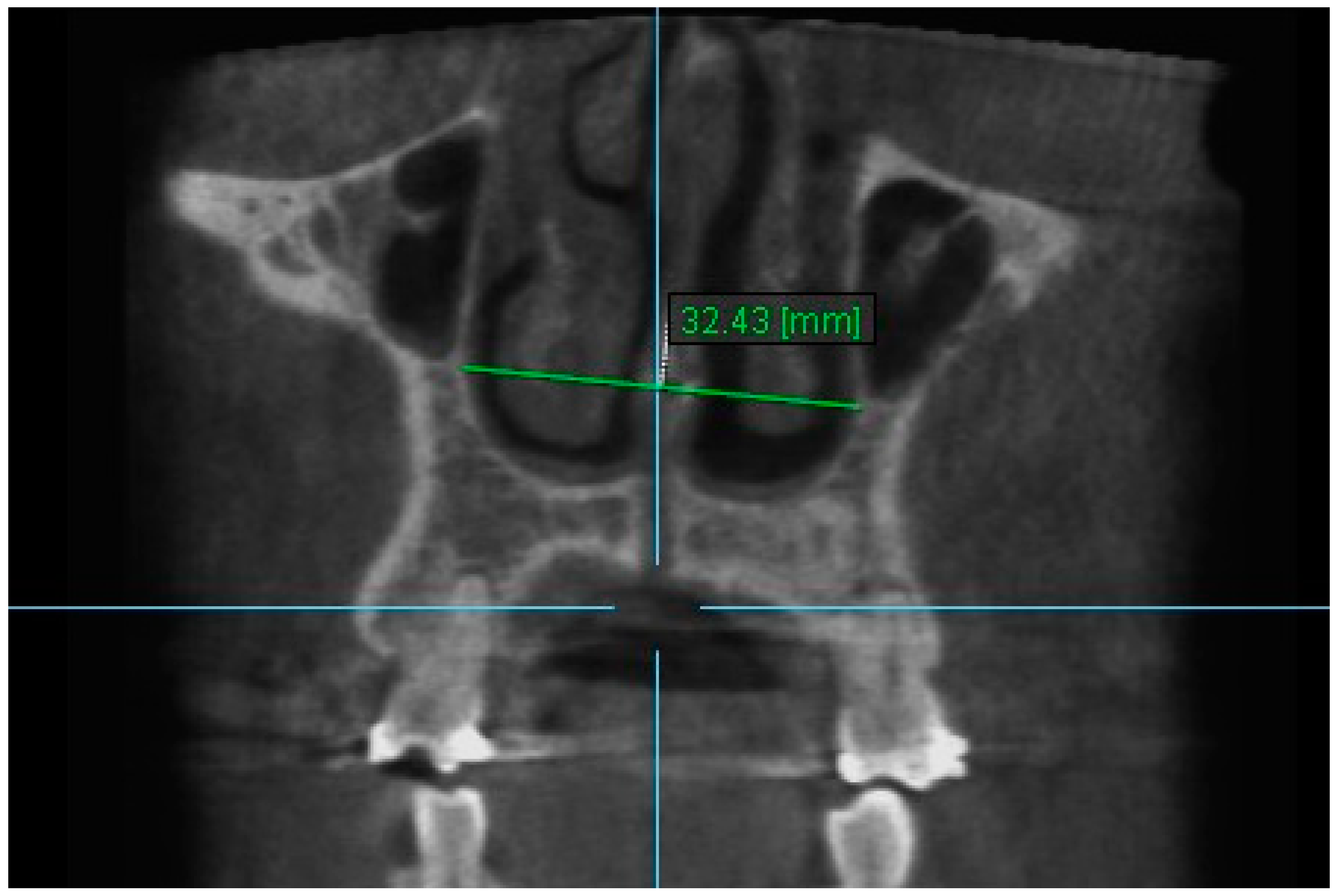 Diagnostics 13 01322 g005