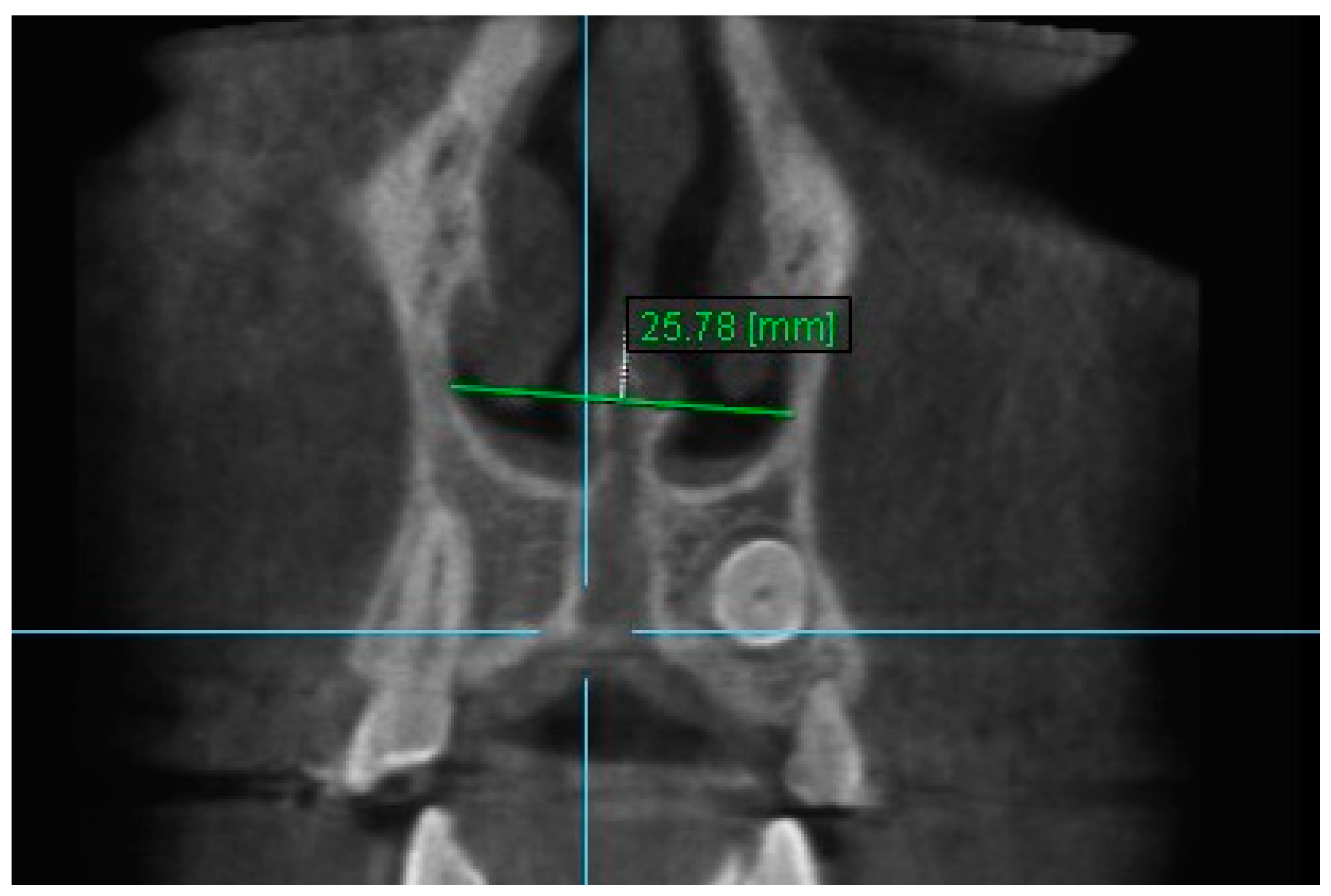 Diagnostics 13 01322 g008
