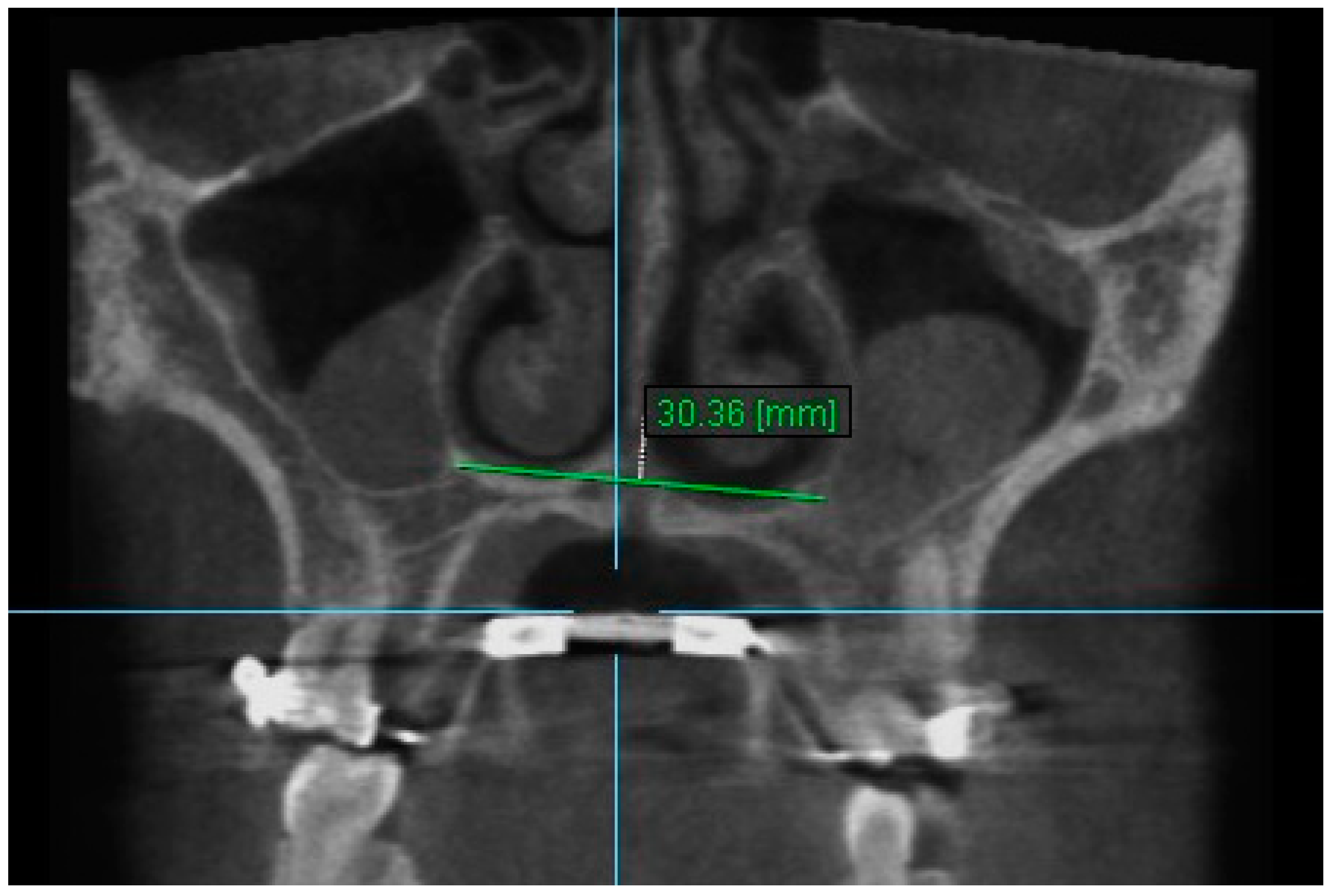 Diagnostics 13 01322 g009