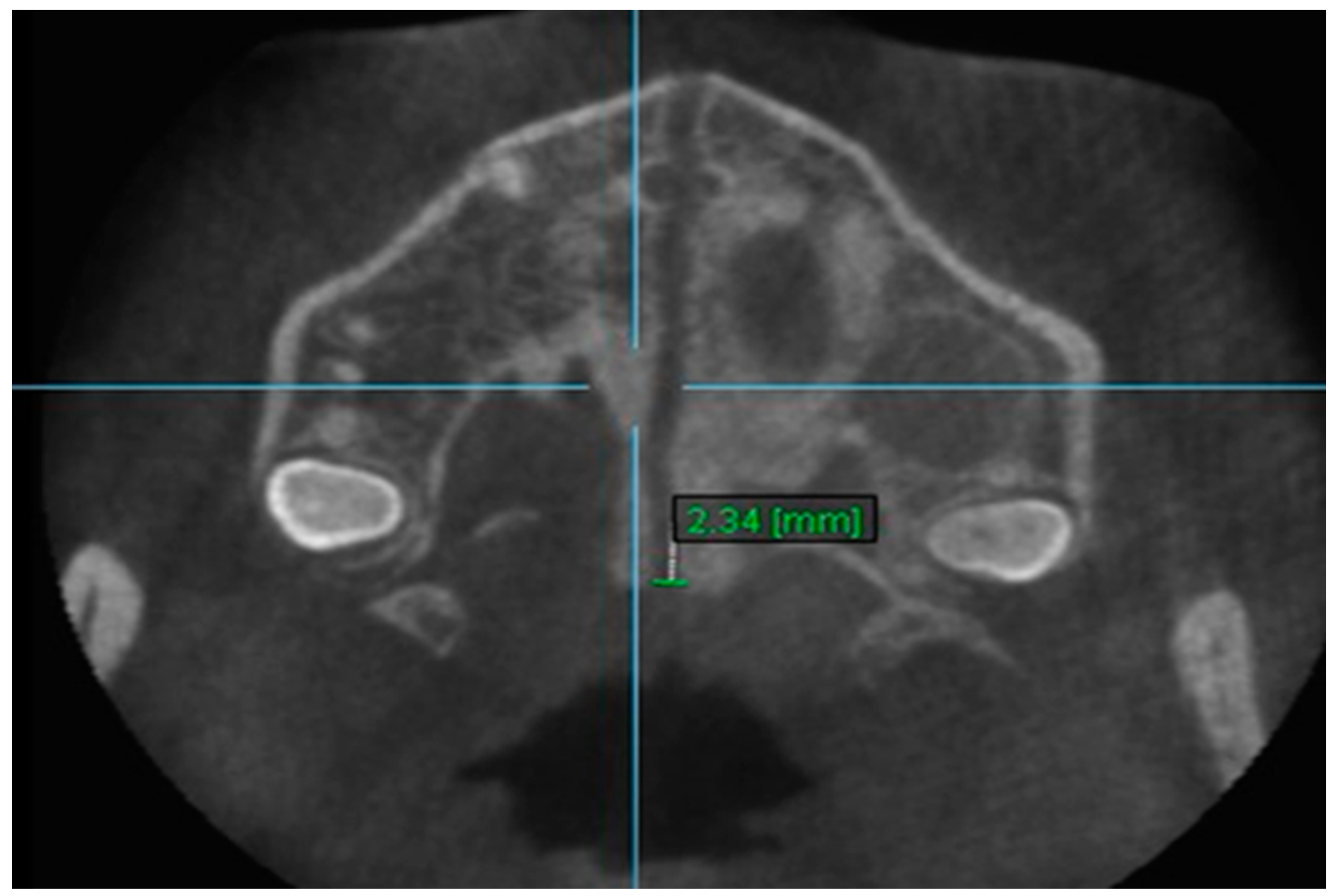 Diagnostics 13 01322 g012