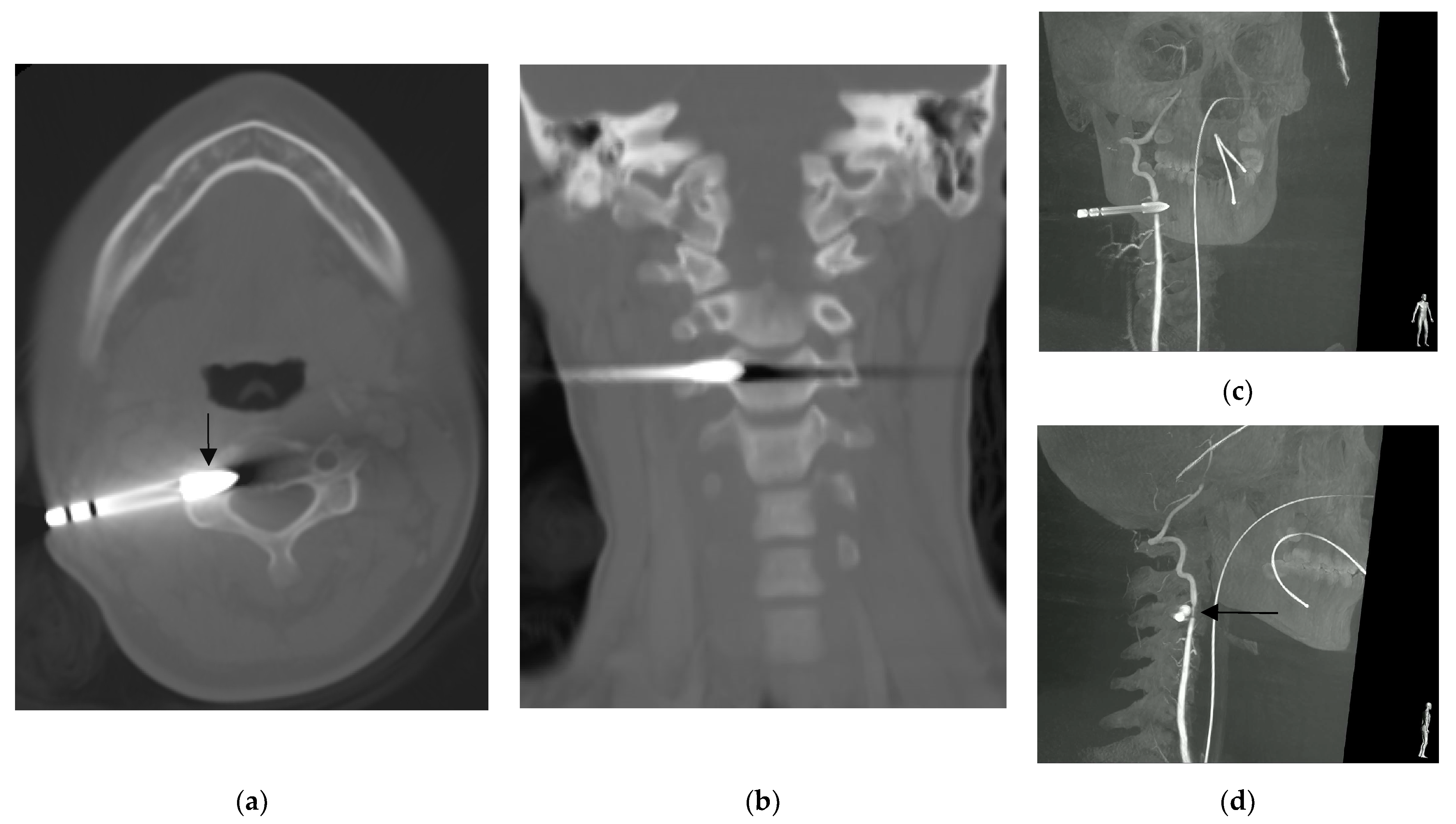 Diagnostics 13 01323 g002 Diagnostics 13 01323 g002