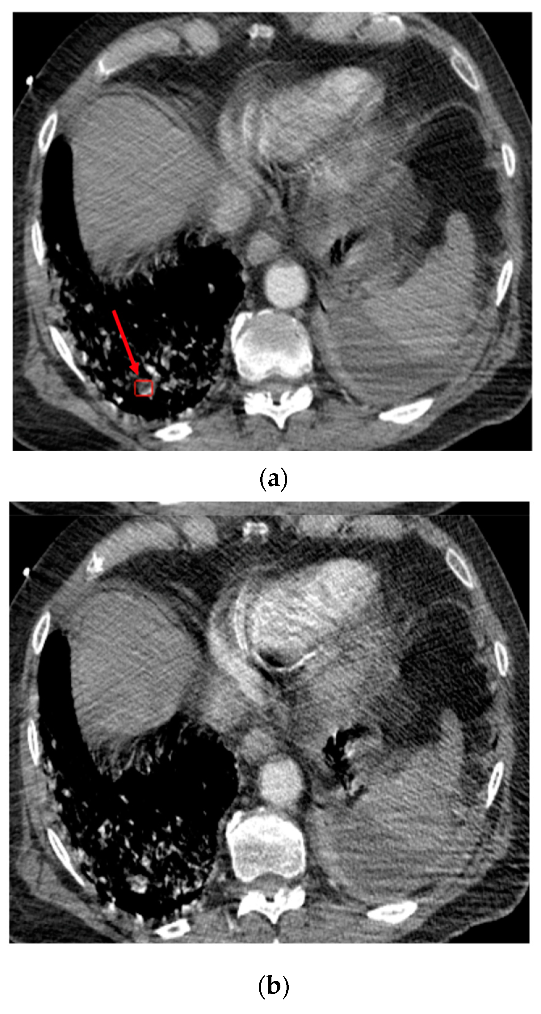 Diagnostics 13 01324 g004 Diagnostics 13 01324 g004