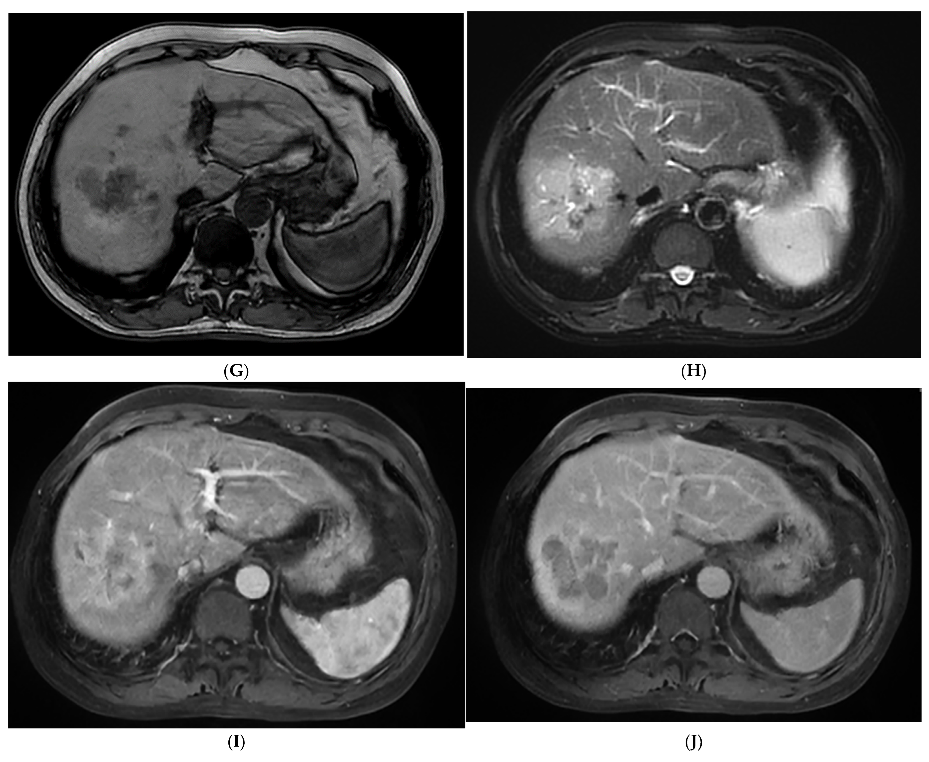 Diagnostics 13 01337 g001b