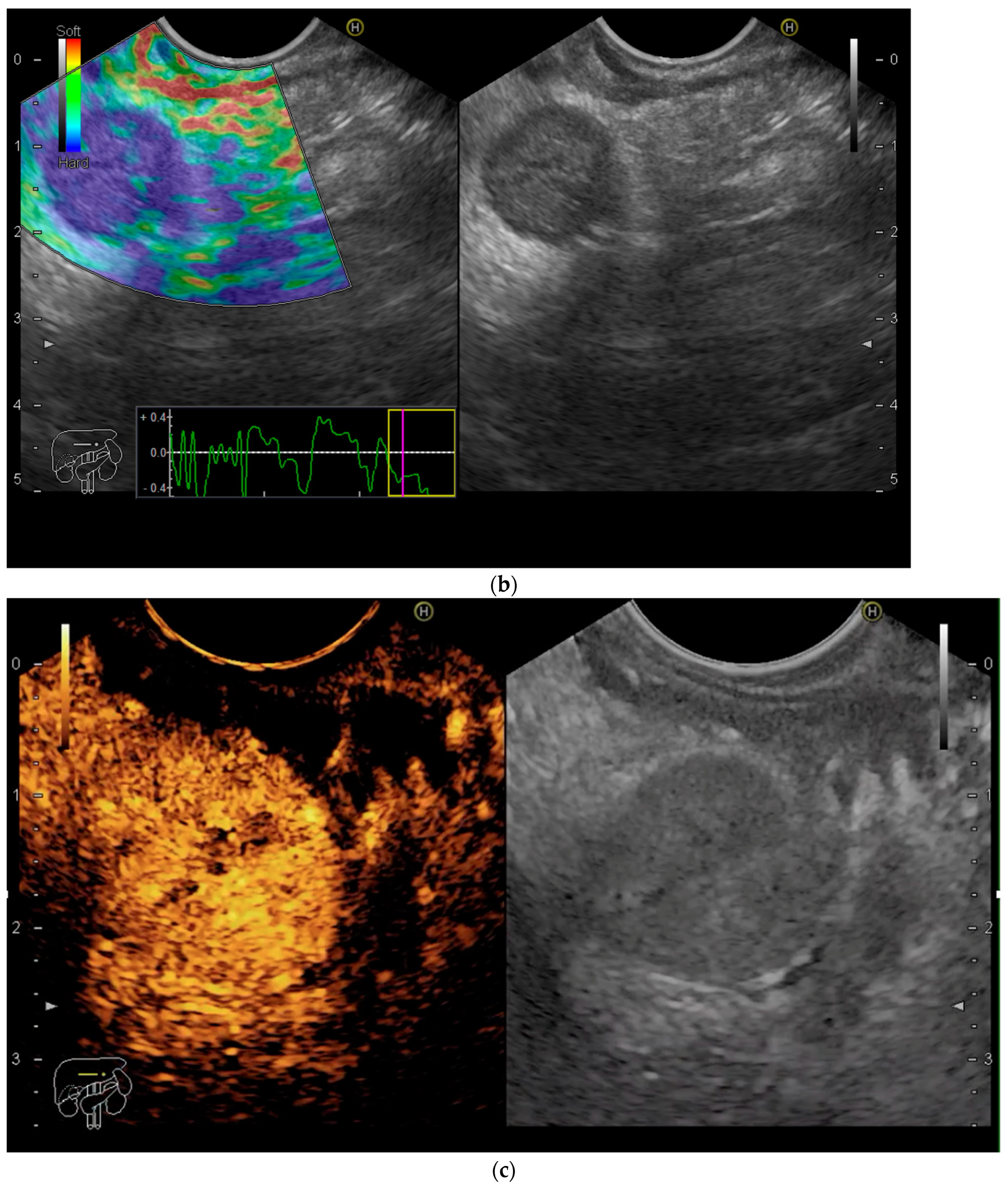 Diagnostics 13 01368 g001b Diagnostics 13 01368 g001b