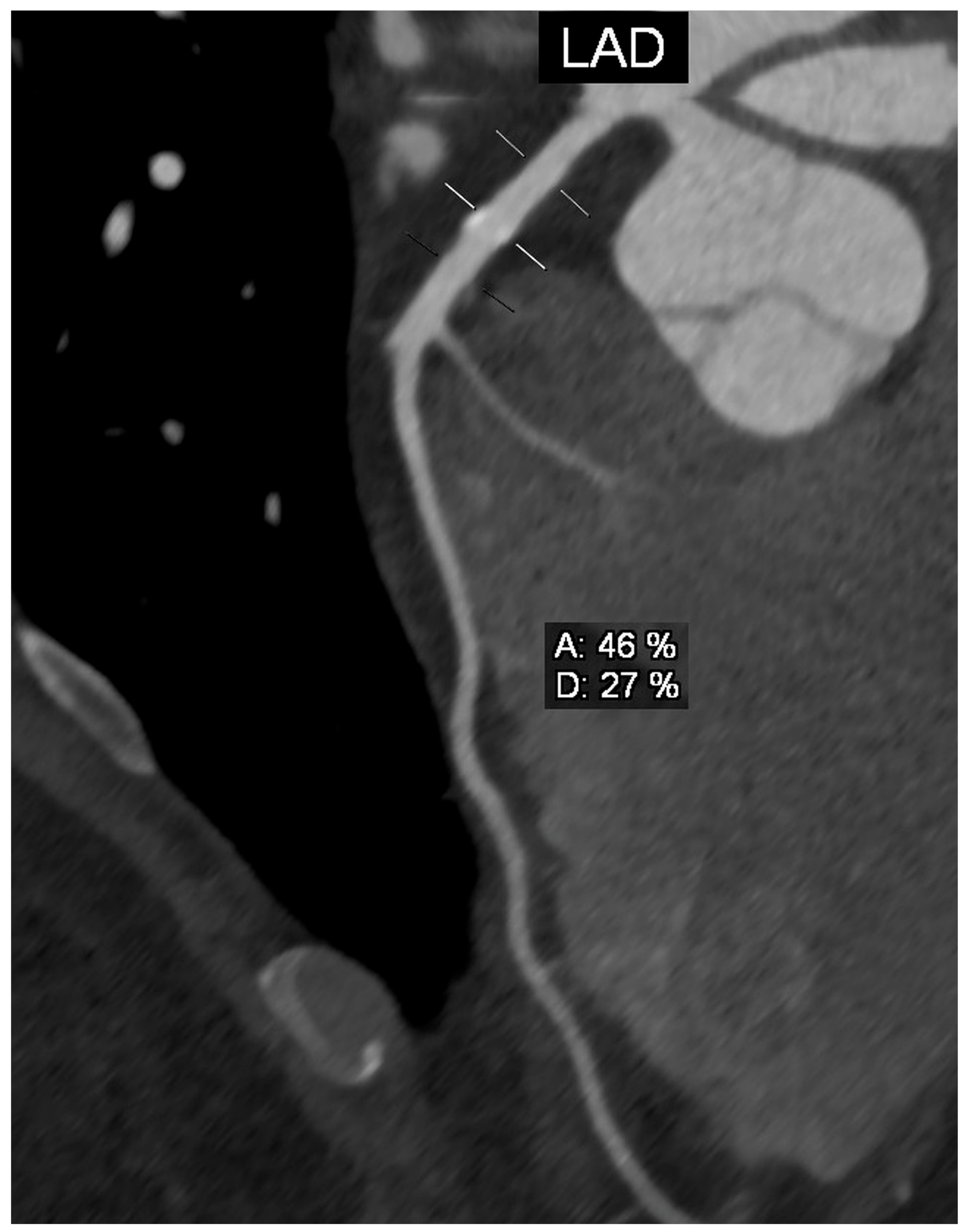 Diagnostics 13 01369 g003 550