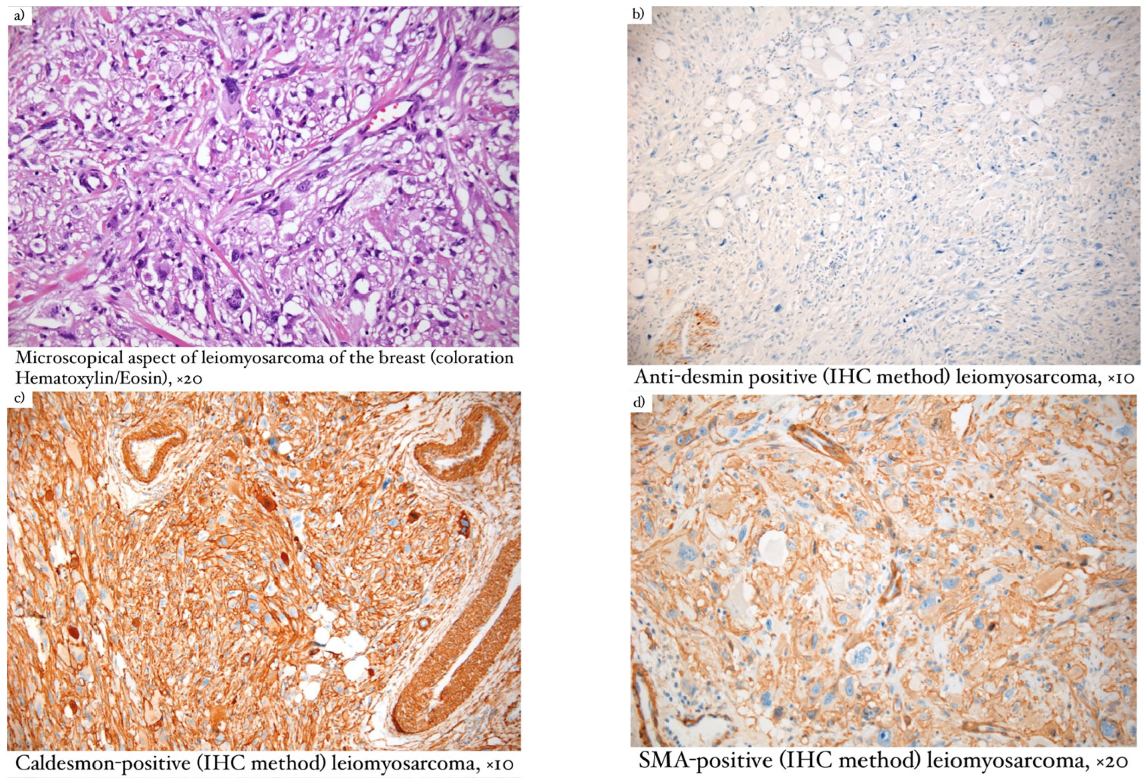 Diagnostics 13 01370 g001a