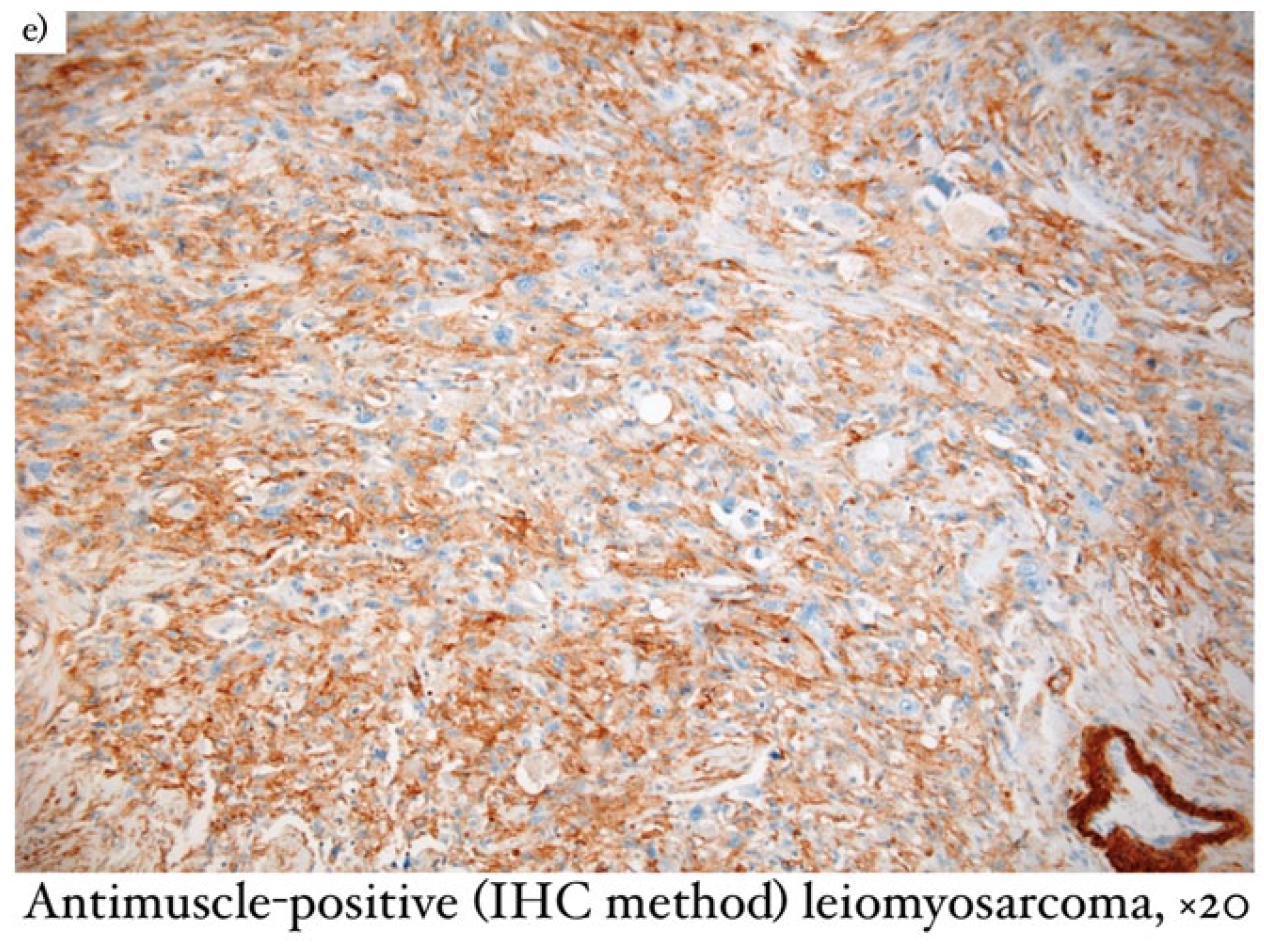 Diagnostics 13 01370 g001b