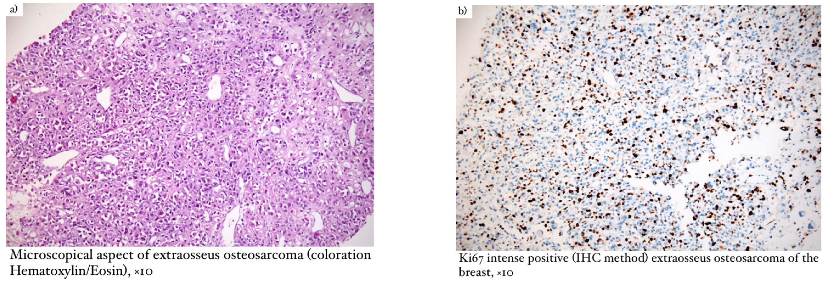 Diagnostics 13 01370 g003a