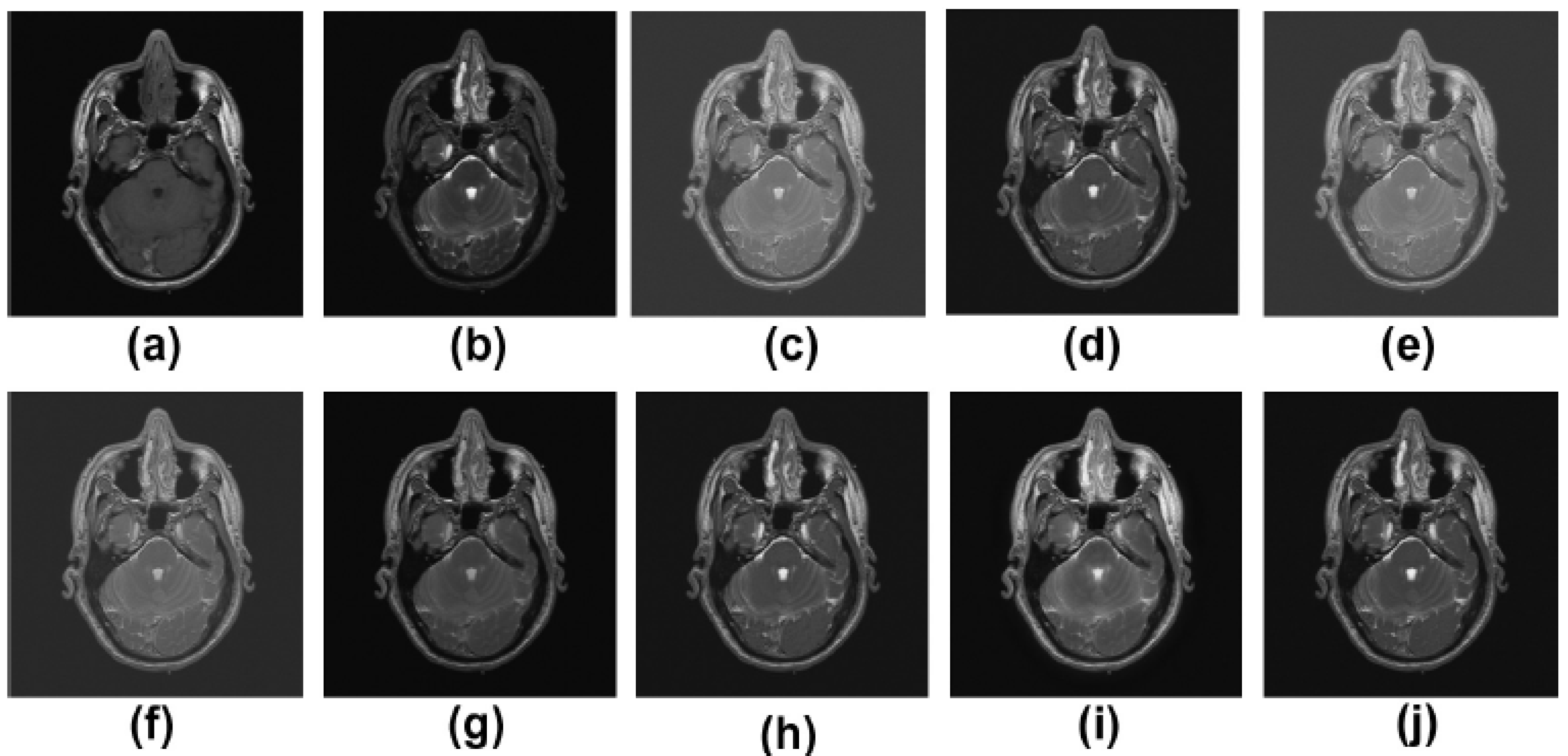 Diagnostics 13 01395 g004