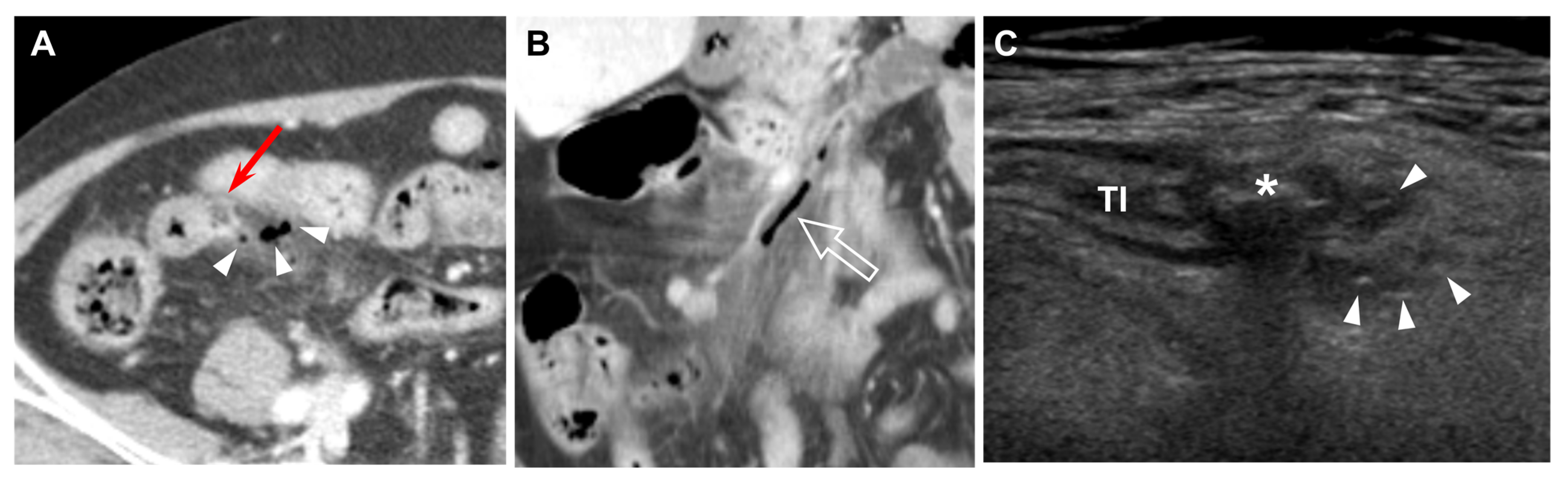 Diagnostics 13 01408 g004
