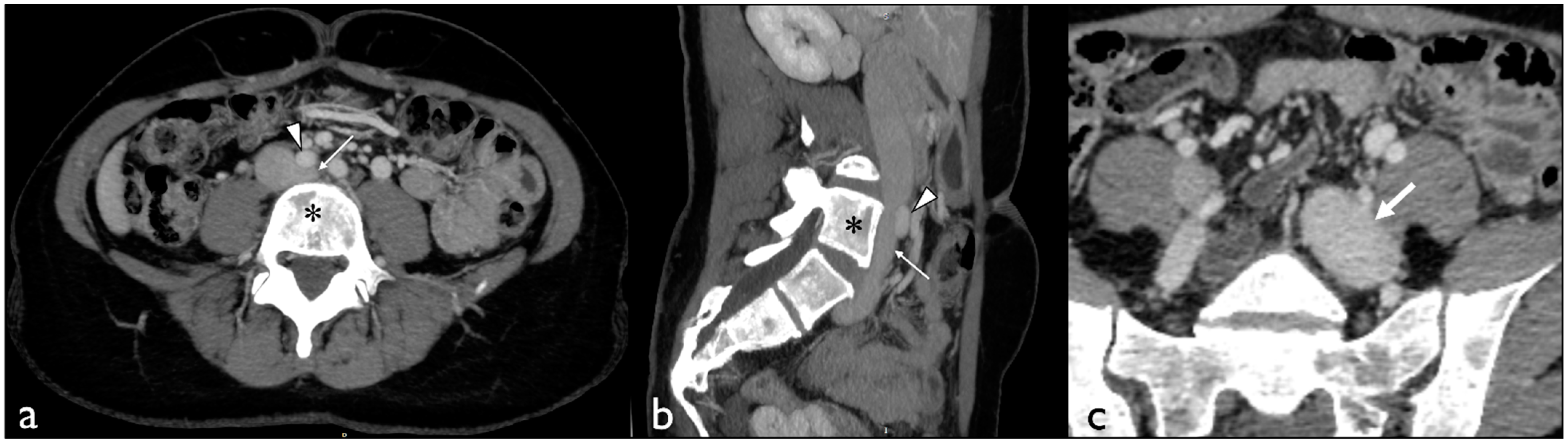 Diagnostics 13 01433 g003
