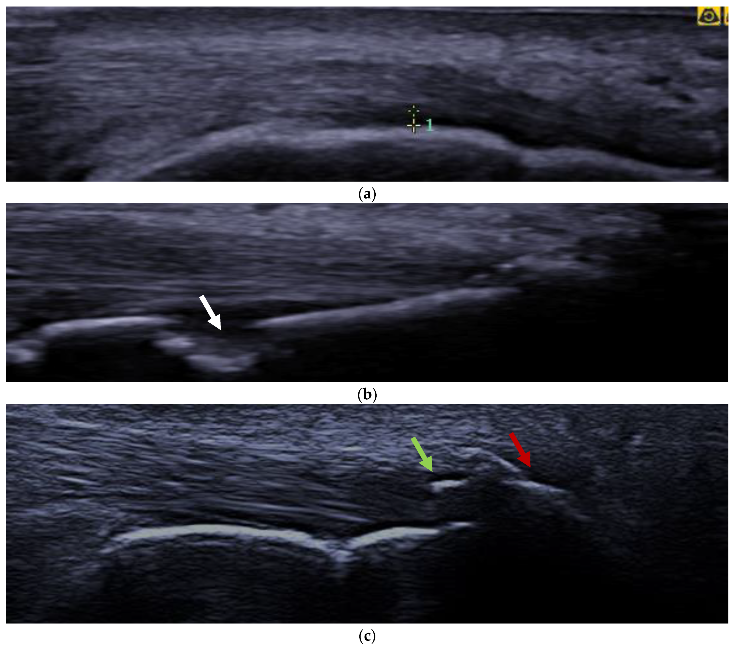 Diagnostics 13 01446 g001 Diagnostics 13 01446 g001