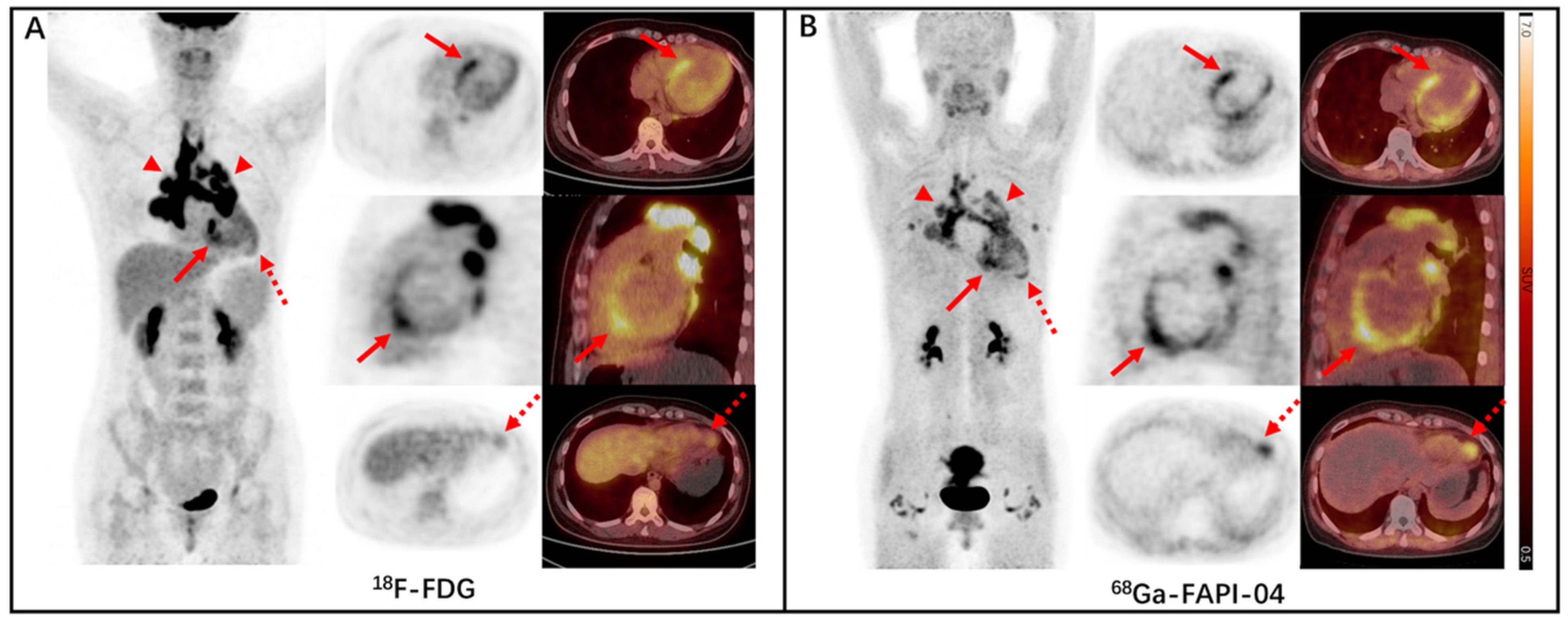 Diagnostics 13 01450 g002 550