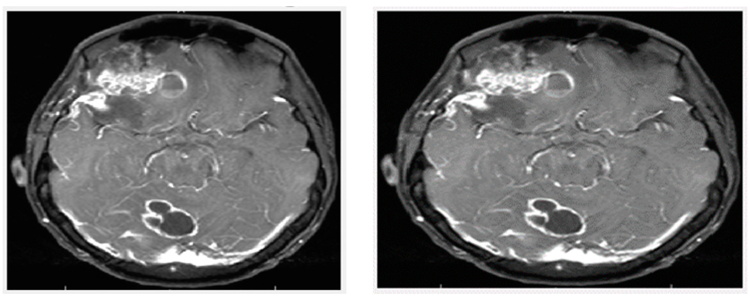 Diagnostics 13 01451 g005