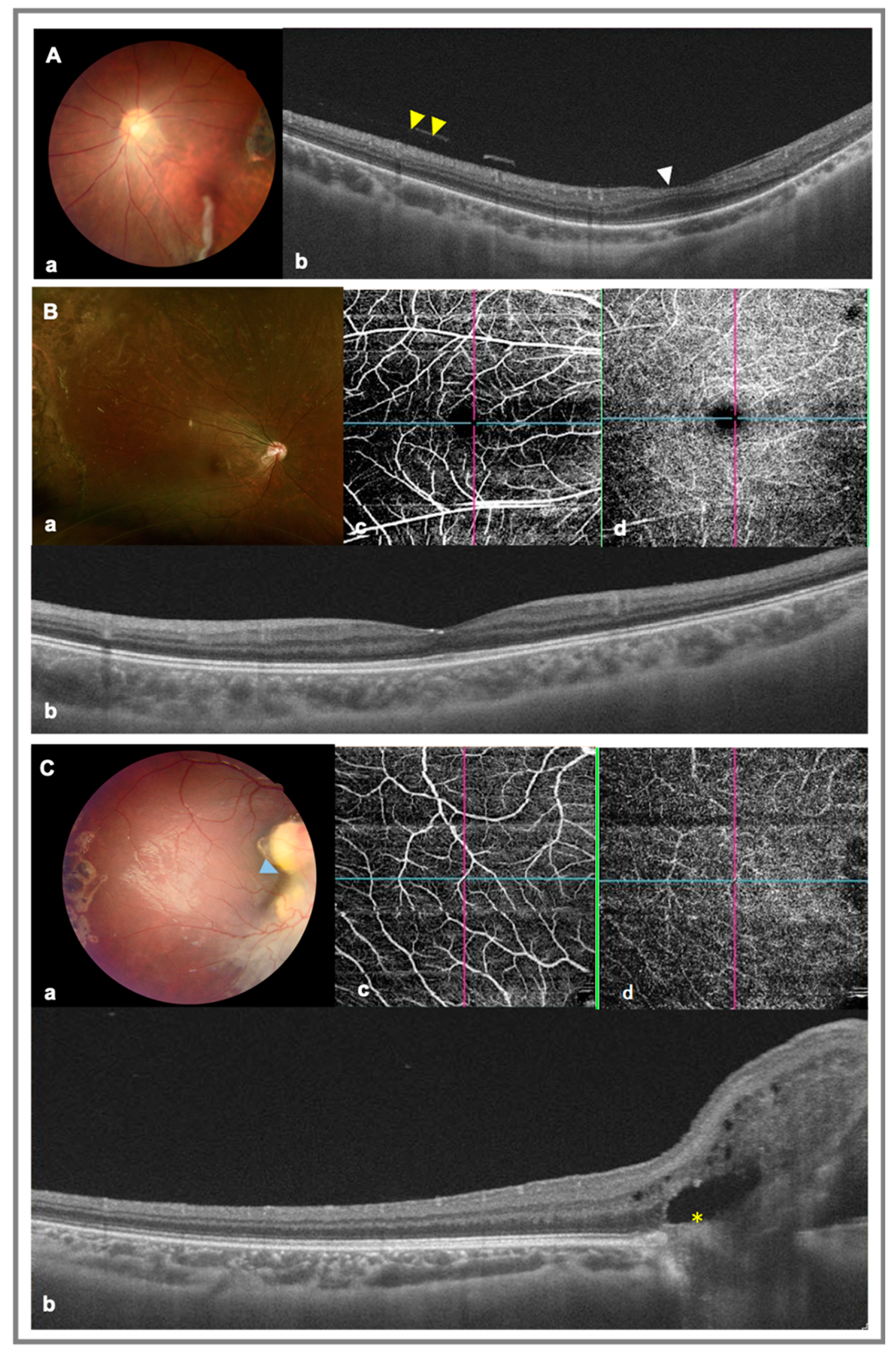 Diagnostics 13 01461 g002
