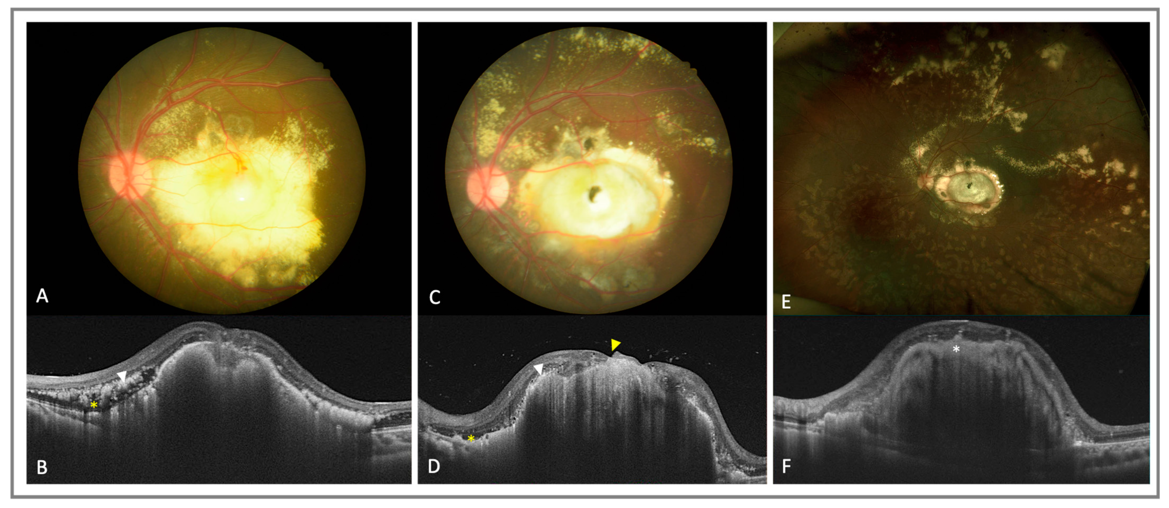 Diagnostics 13 01461 g003