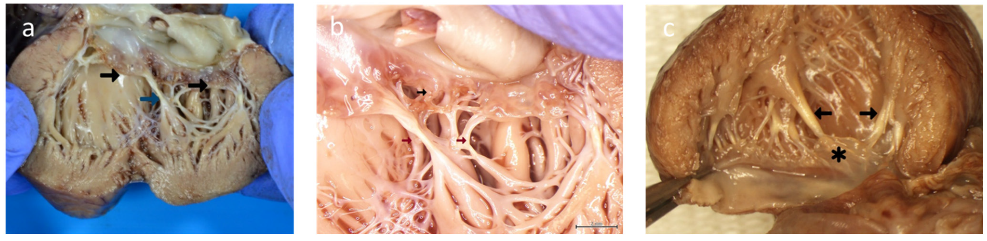 Diagnostics 13 01481 g006 Diagnostics 13 01481 g006