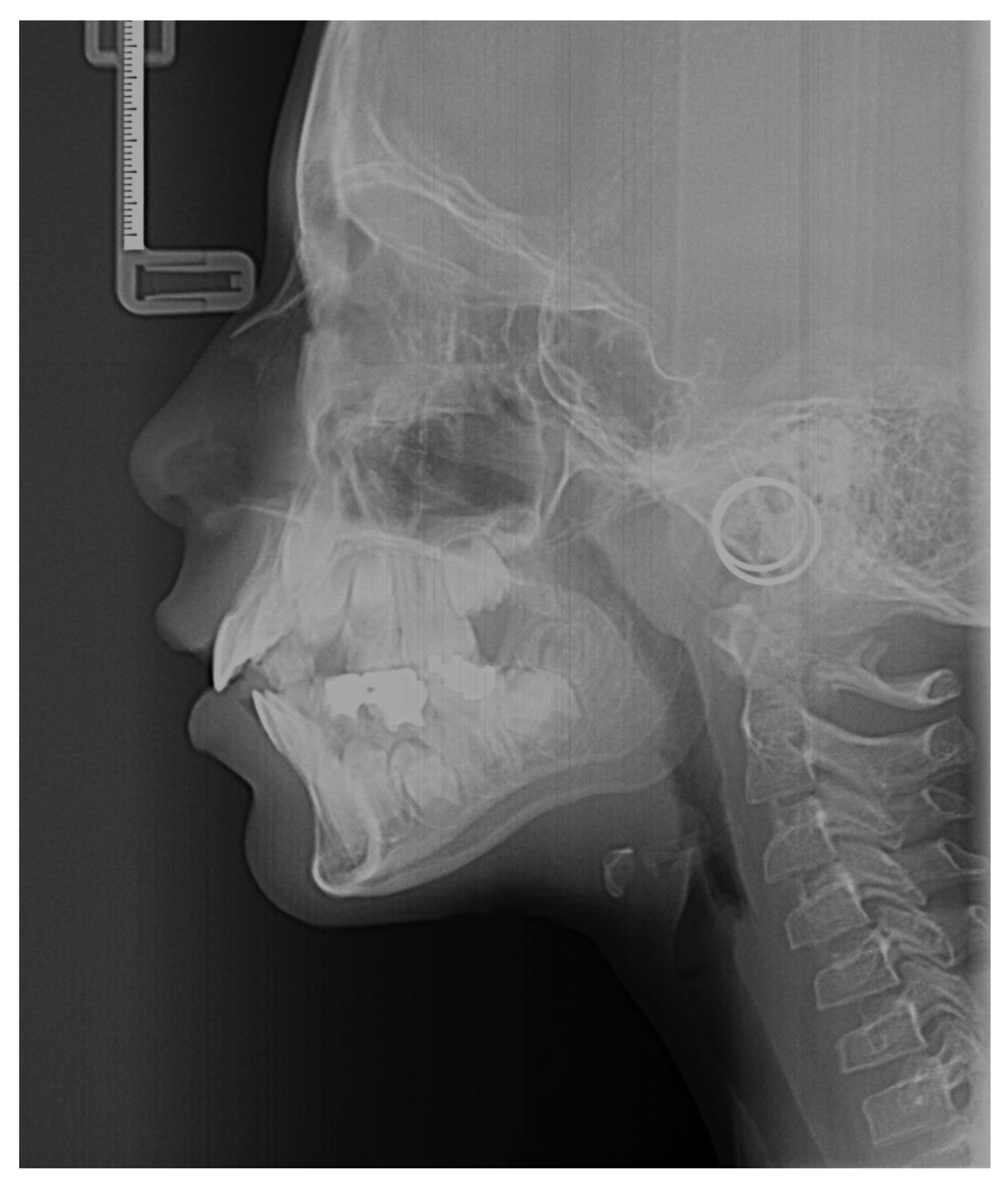 Diagnostics 13 01485 g001