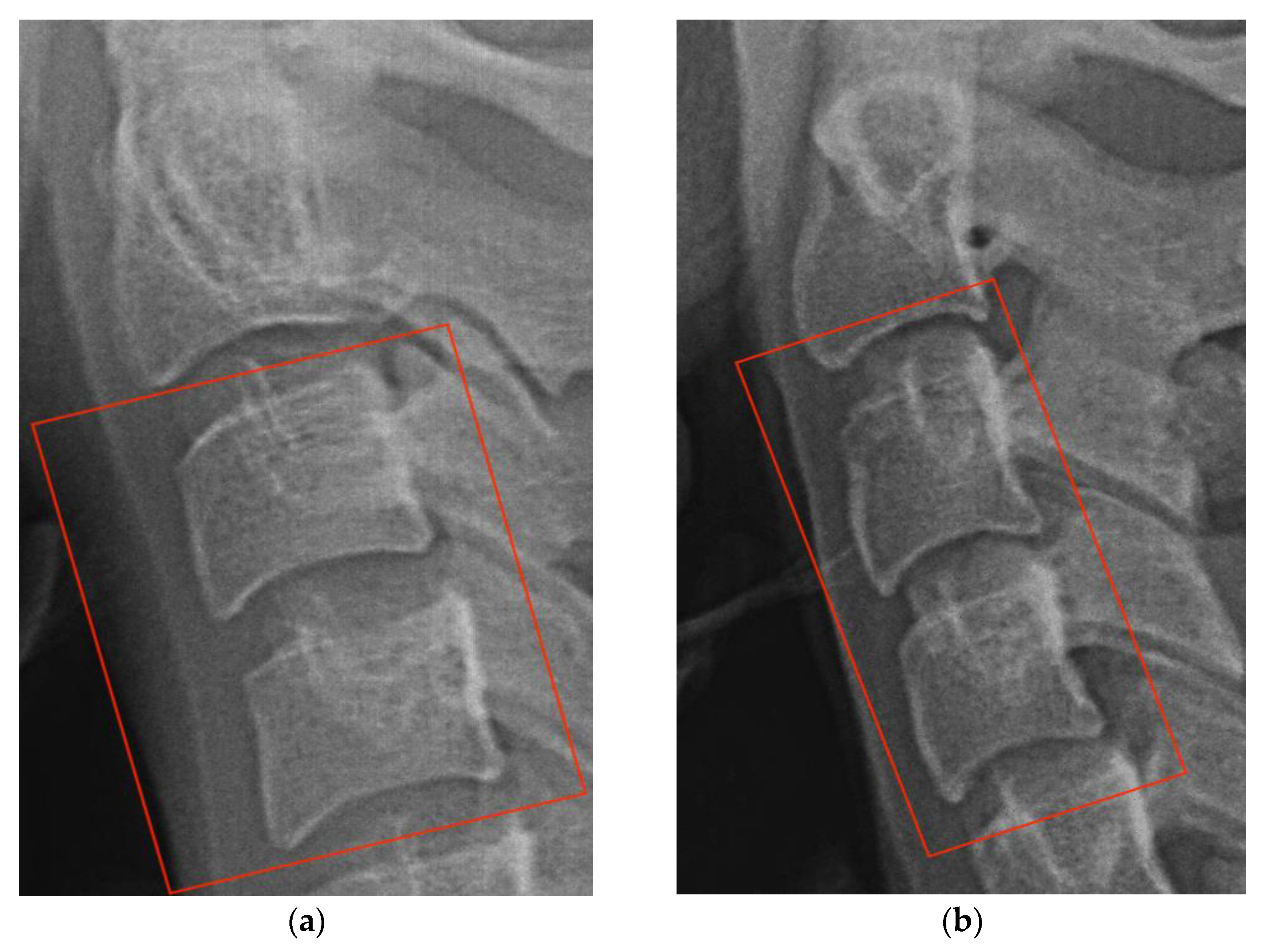 Diagnostics 13 01485 g003