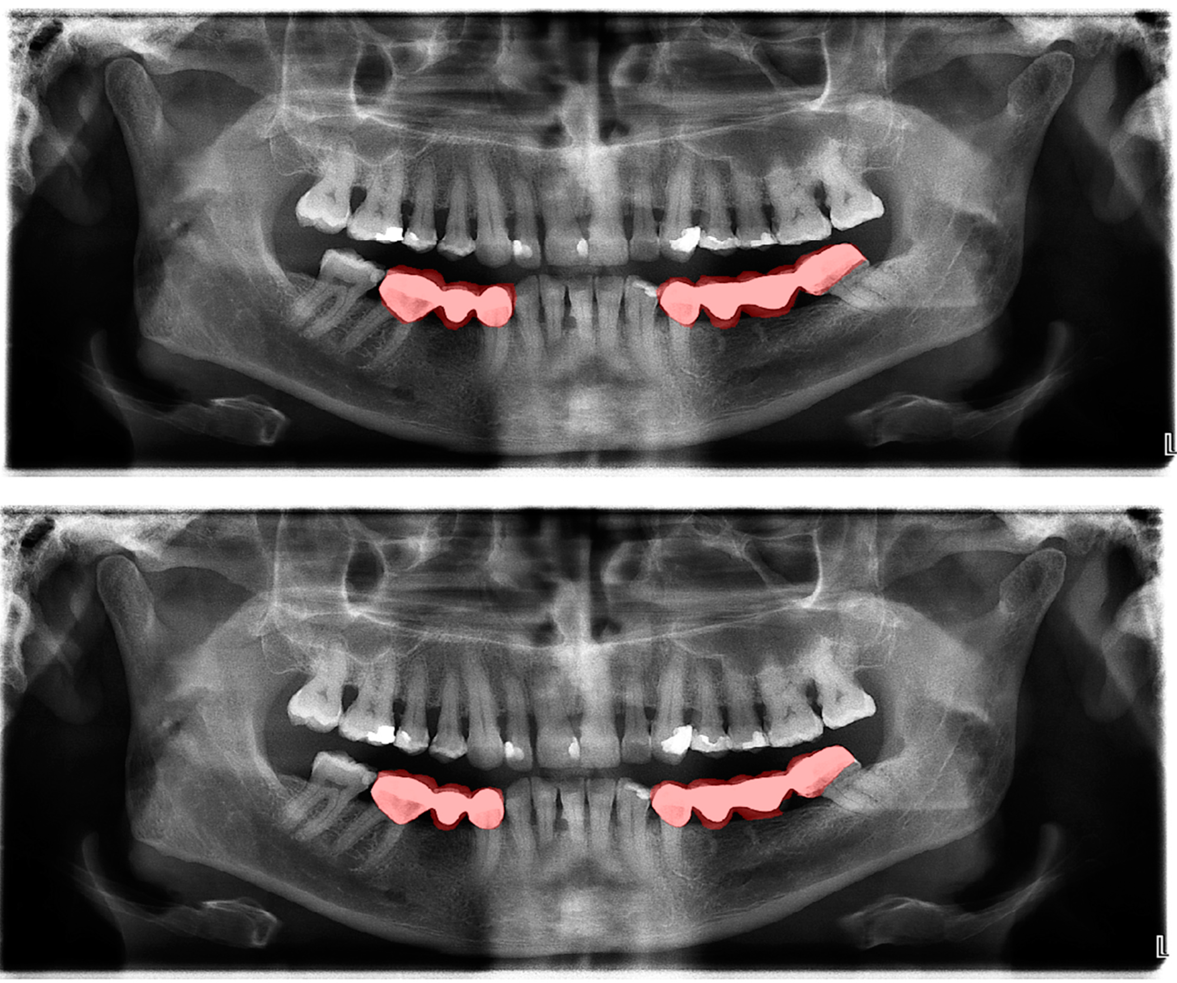 Diagnostics 13 01487 g004 Diagnostics 13 01487 g004