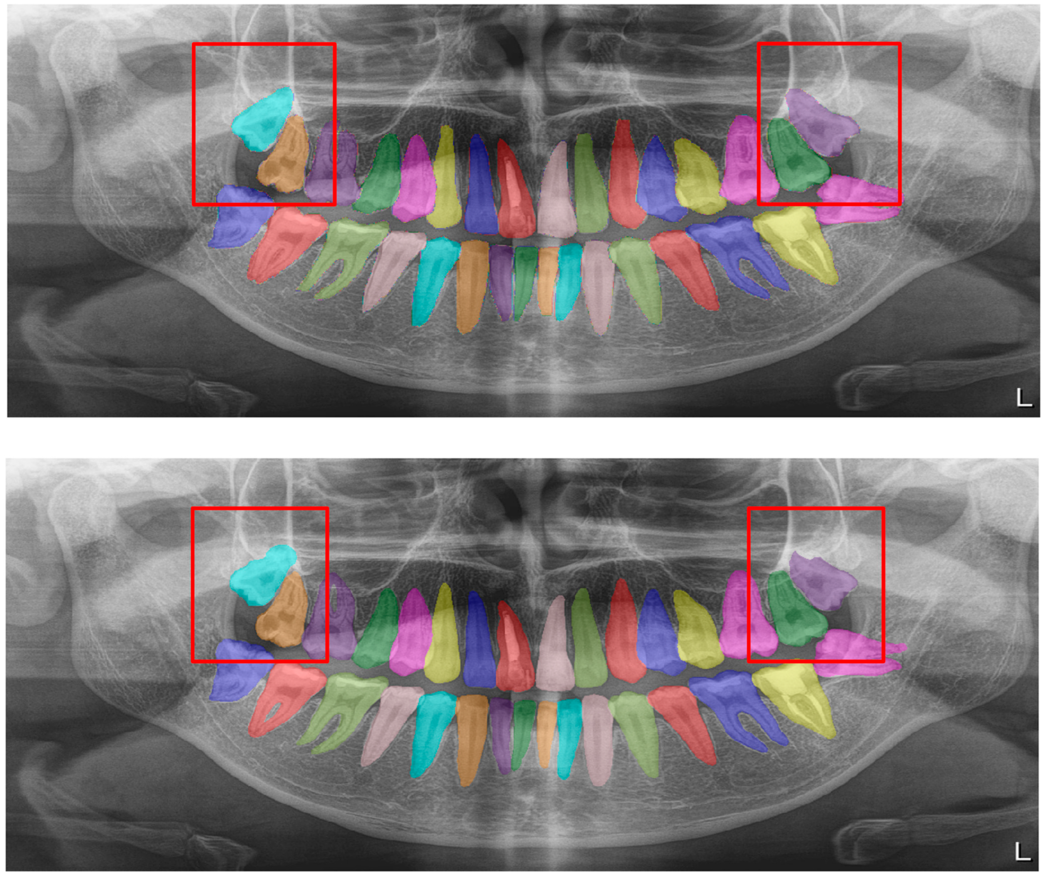 Diagnostics 13 01487 g008 Diagnostics 13 01487 g008