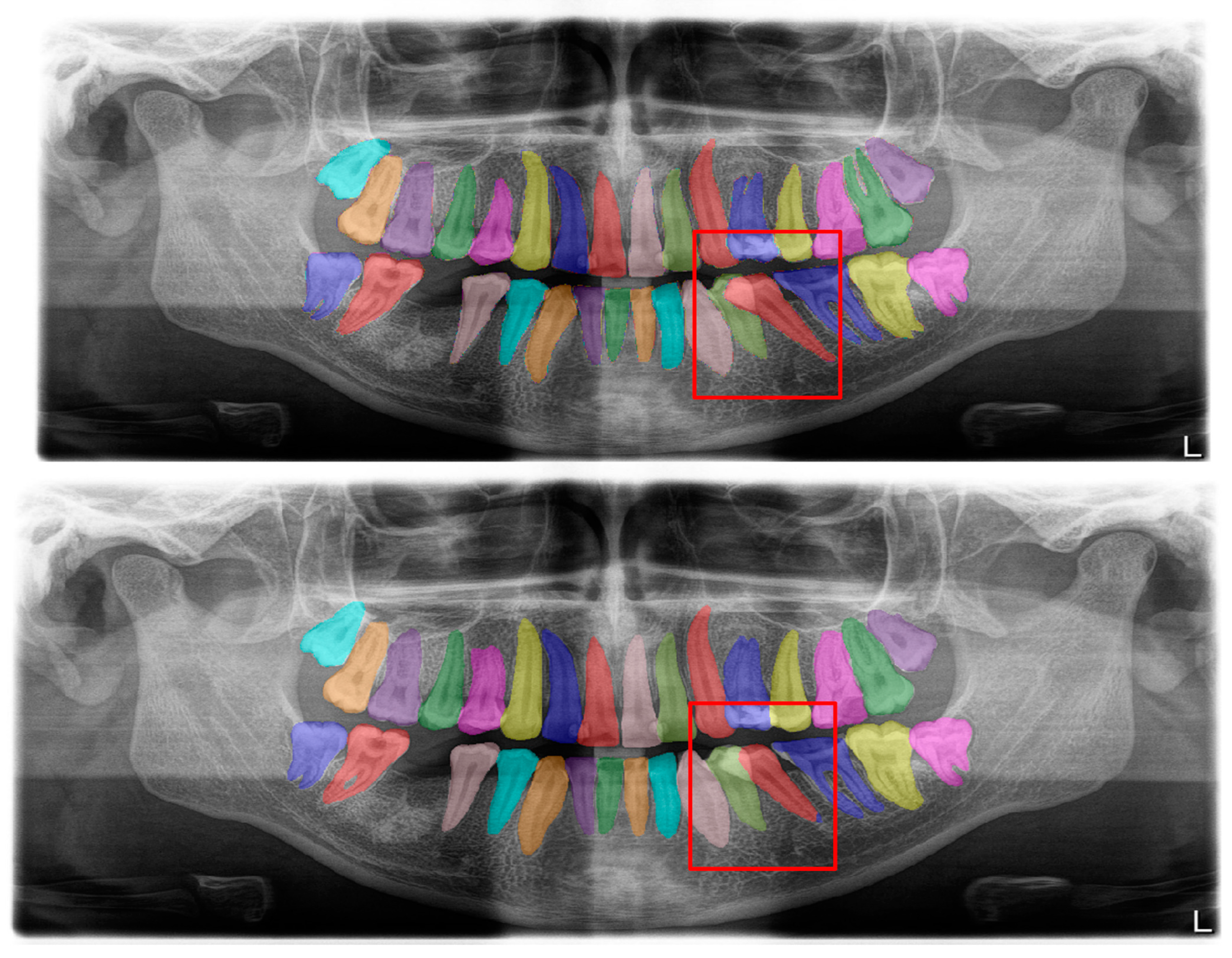 Diagnostics 13 01487 g009 Diagnostics 13 01487 g009